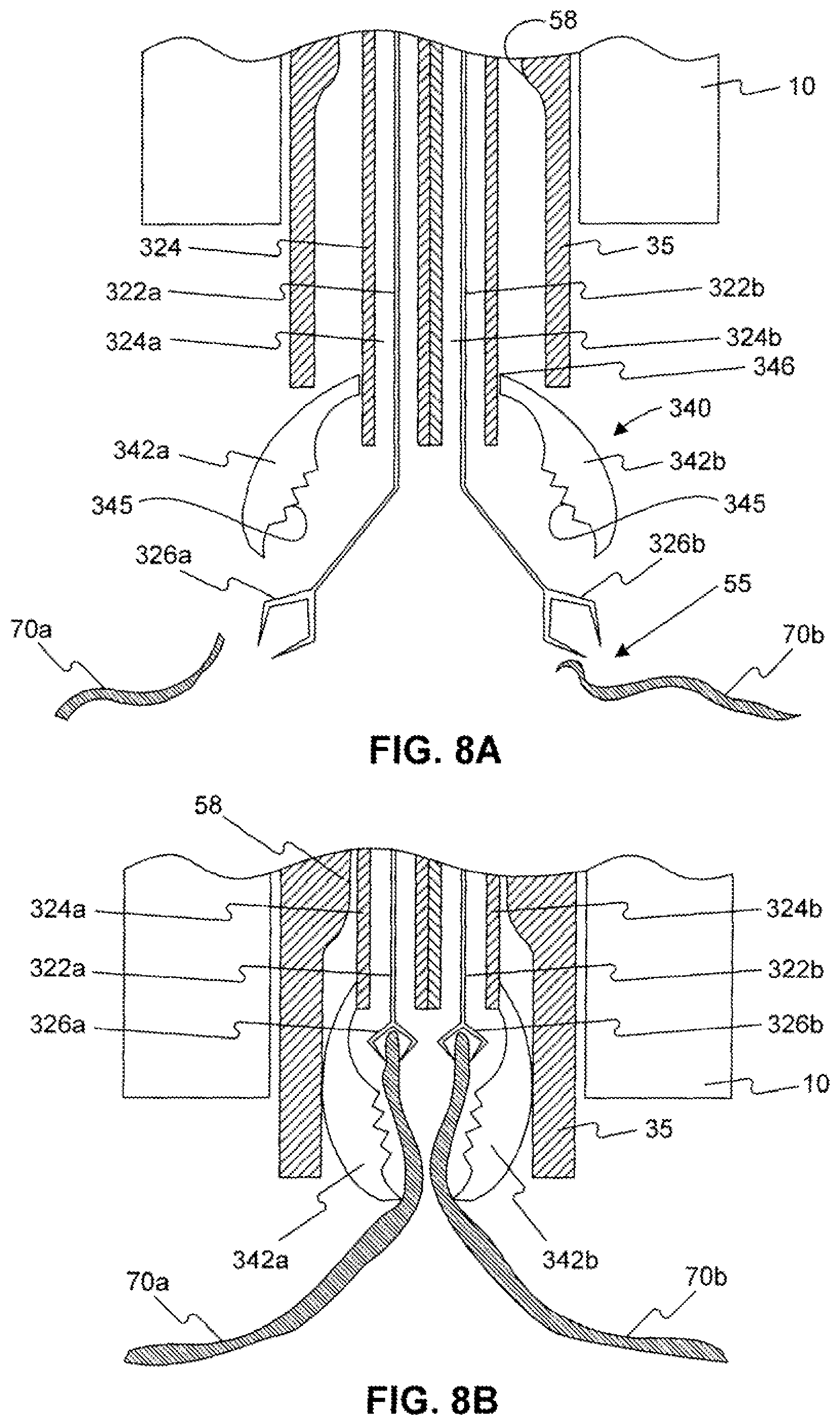 Patent US12310588 Figure 9 – Devices for approximating tissue and related methods of use