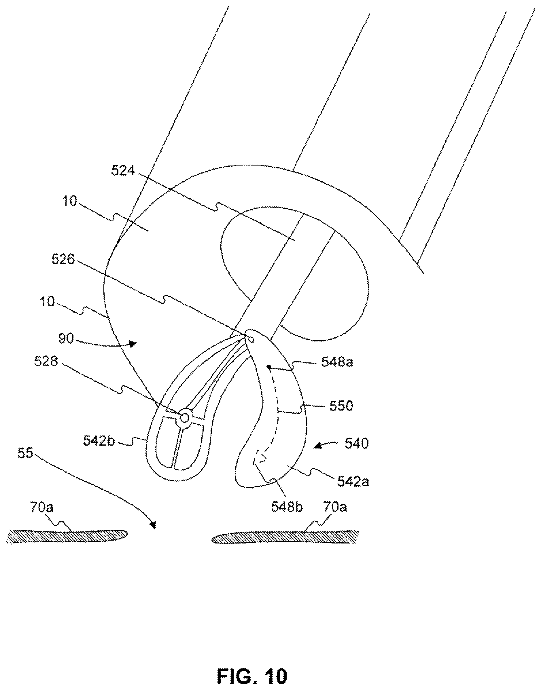 Patent US12310588 Figure 11 – Devices for approximating tissue and related methods of use