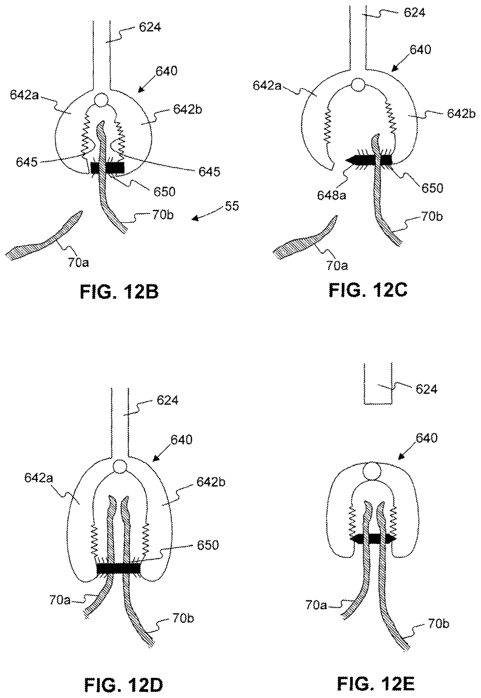 Patent US12310588 Figure 15 – Devices for approximating tissue and related methods of use