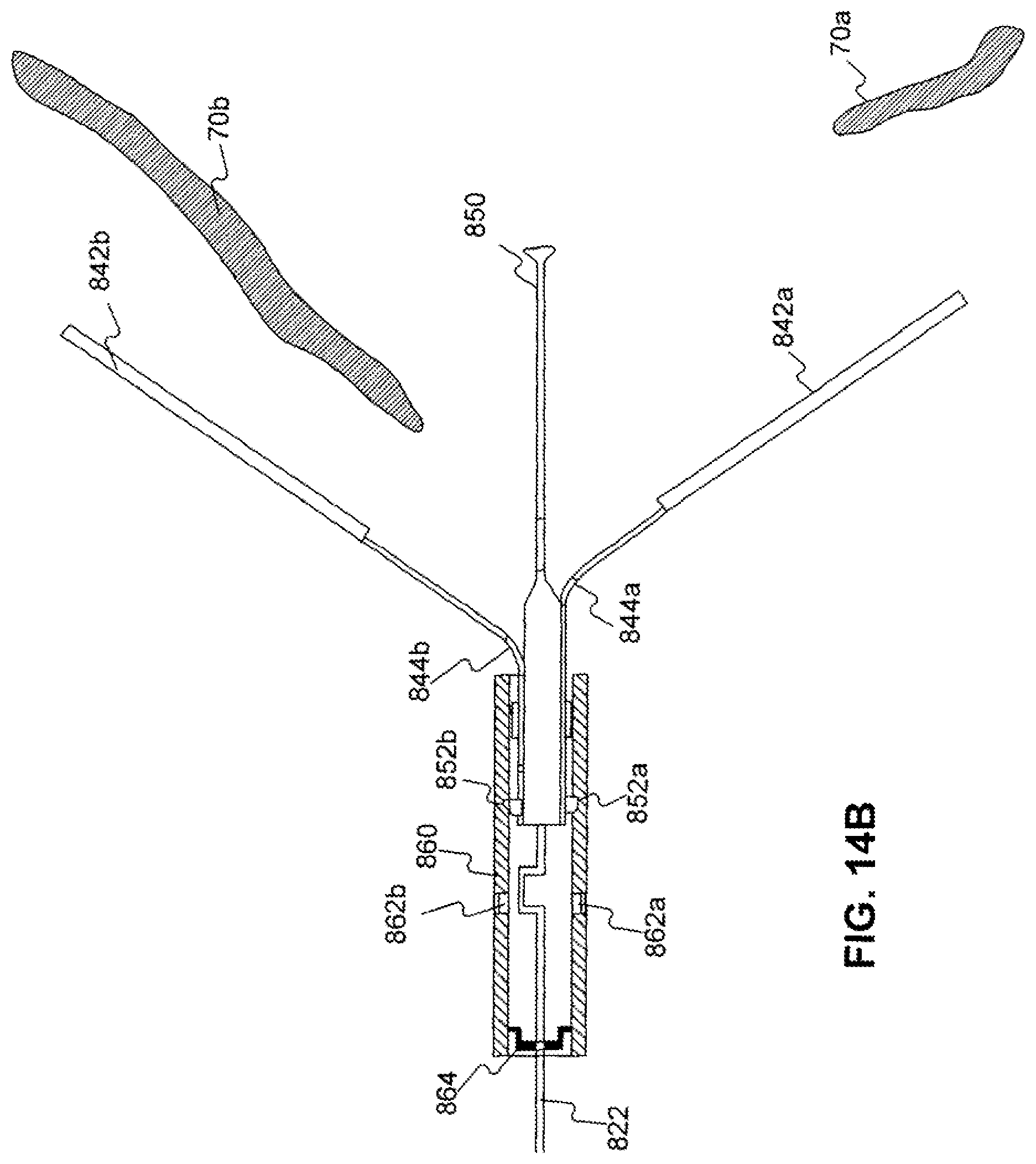 Patent US12310588 Figure 19 – Devices for approximating tissue and related methods of use