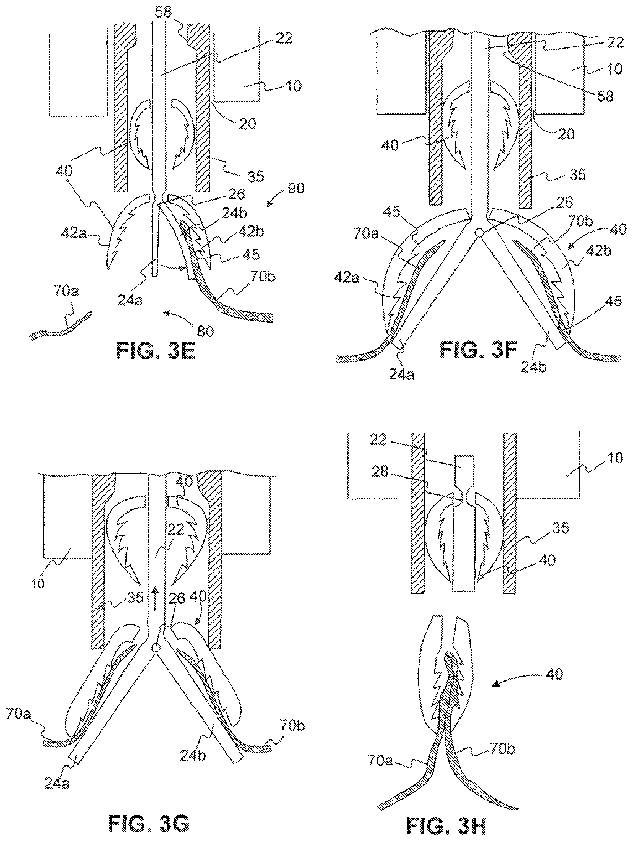 Patent US12310589 Figure 4 – Devices for approximating tissue and related methods of use