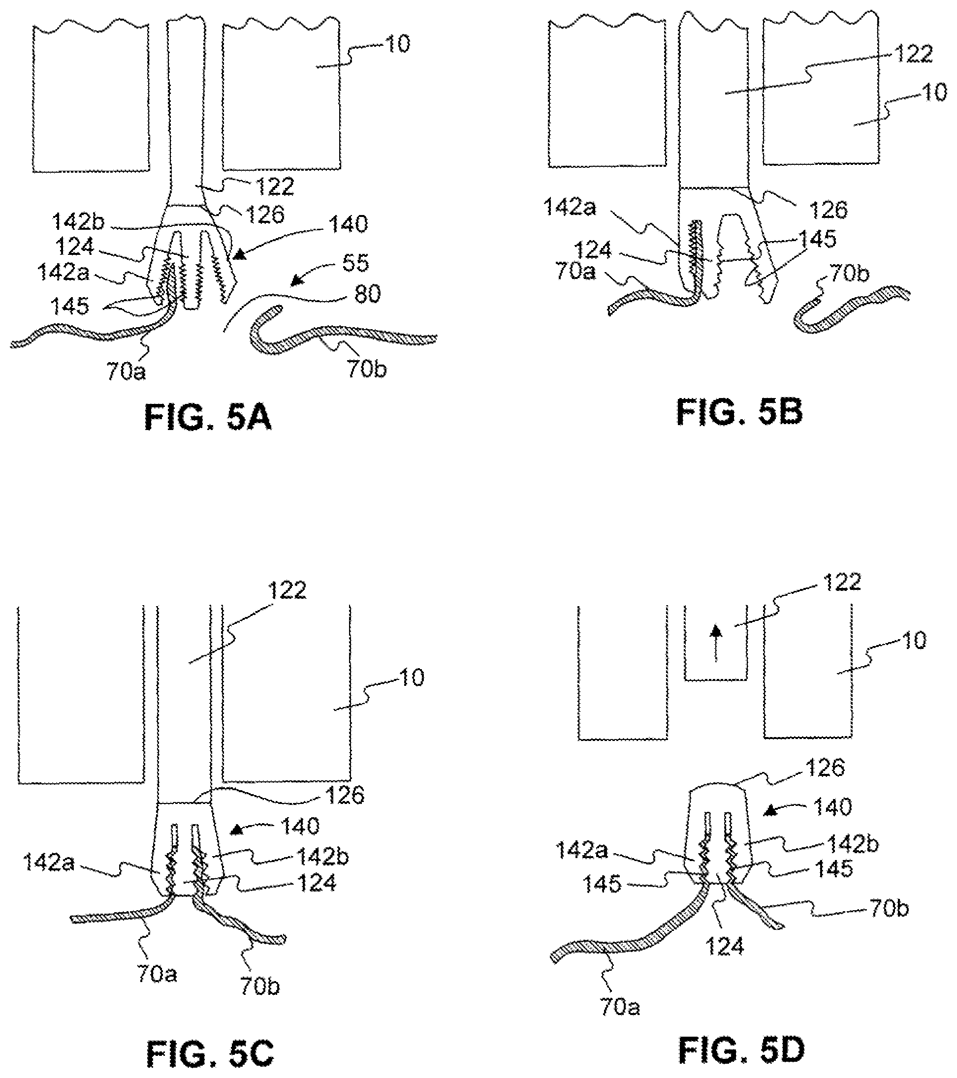 Patent US12310589 Figure 6 – Devices for approximating tissue and related methods of use
