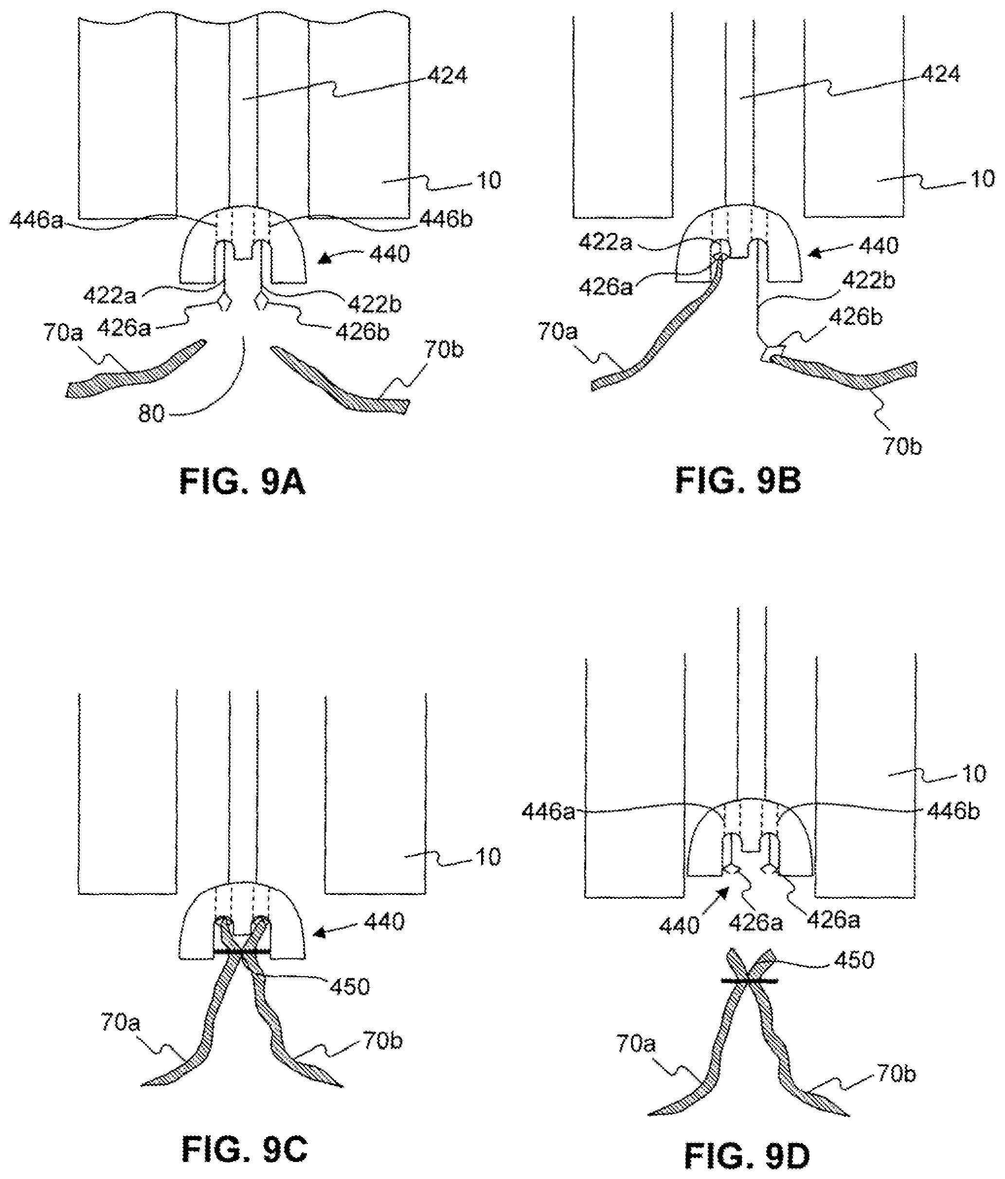 Patent US12310589 Figure 10 – Devices for approximating tissue and related methods of use
