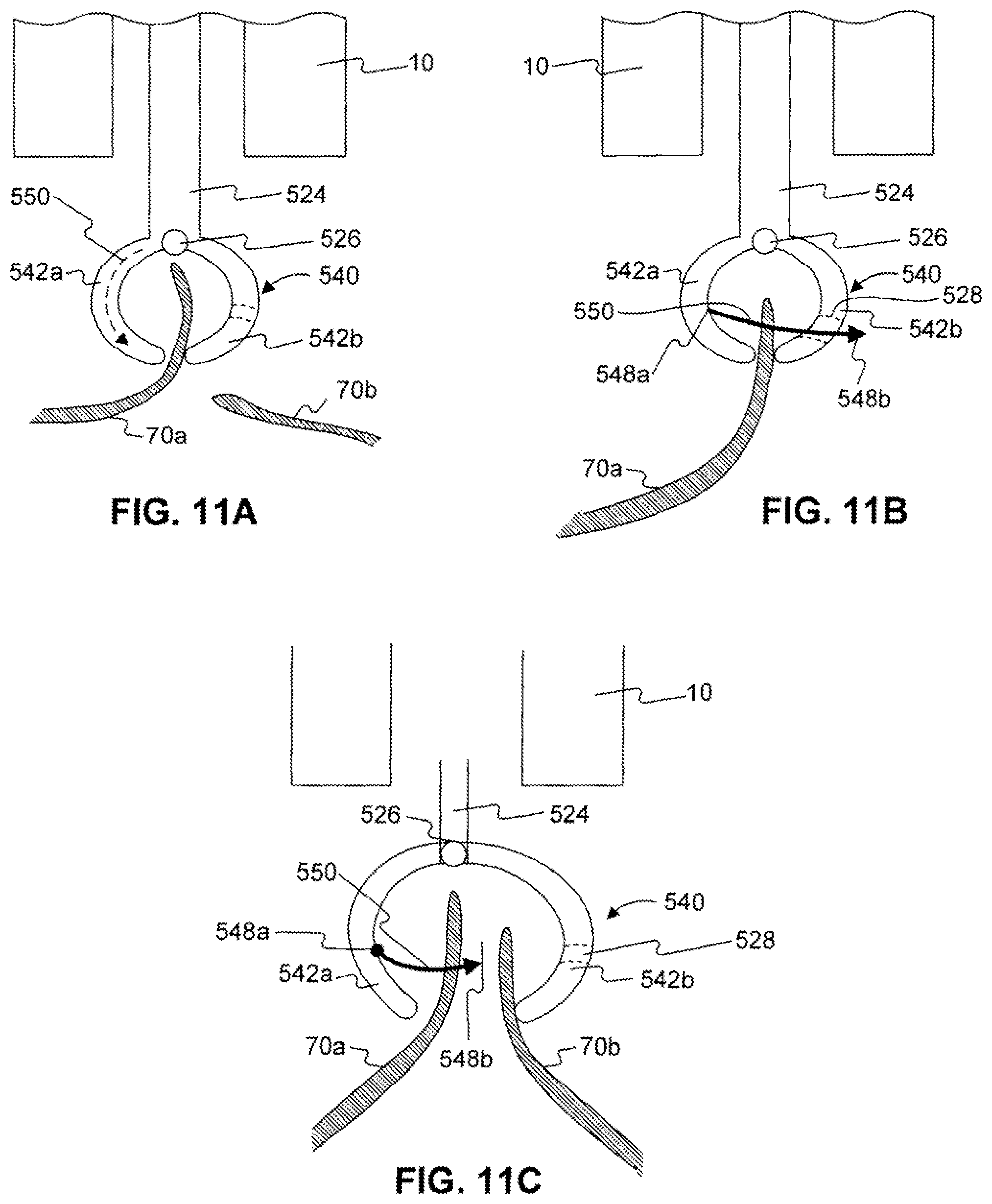 Patent US12310589 Figure 12 – Devices for approximating tissue and related methods of use