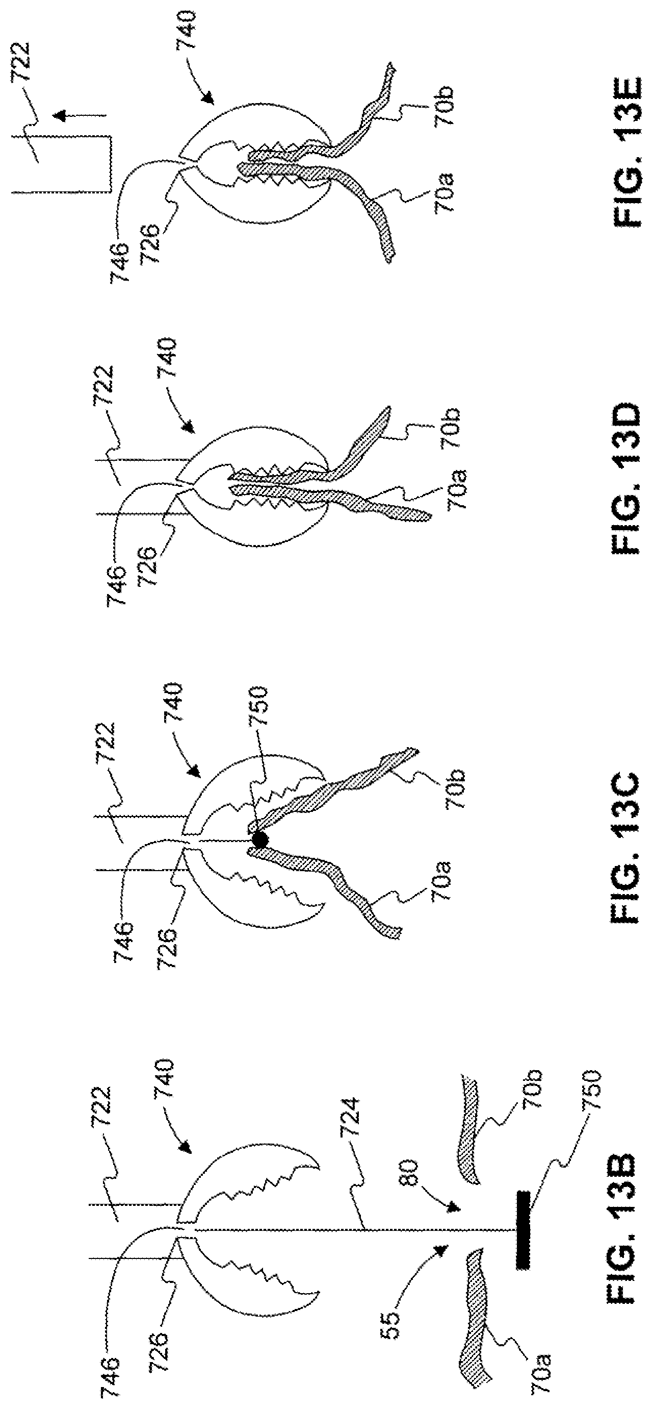 Patent US12310589 Figure 17 – Devices for approximating tissue and related methods of use