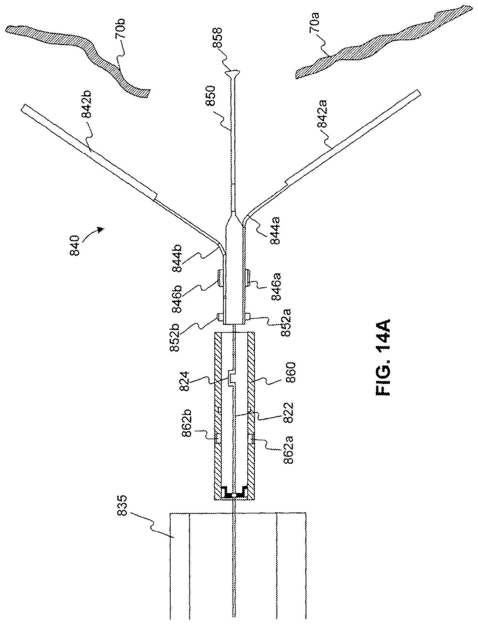Patent US12310589 Figure 18 – Devices for approximating tissue and related methods of use