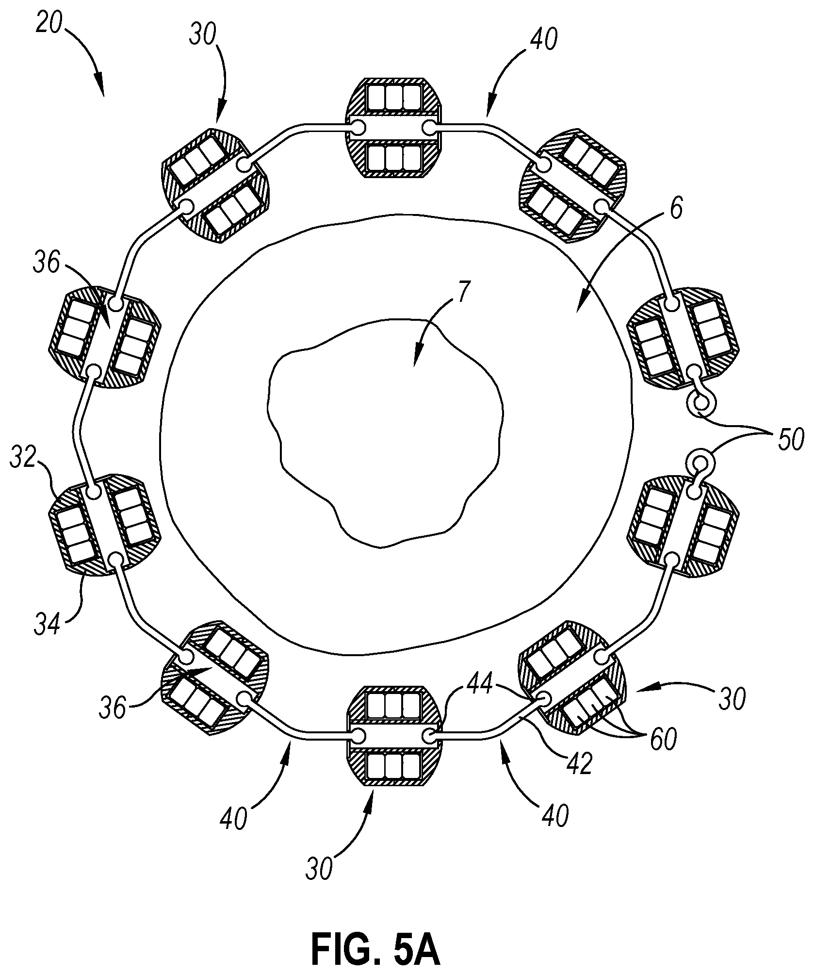 Patent US12310593 Figure 5 – Implantable sphincter device with bead orientation control based on bead interactive geometry