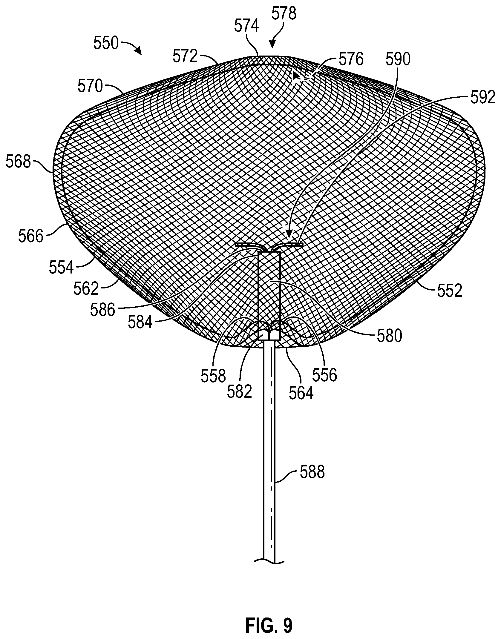Patent US12310595 Figure 4 – Systems and methods for treating aneurysms