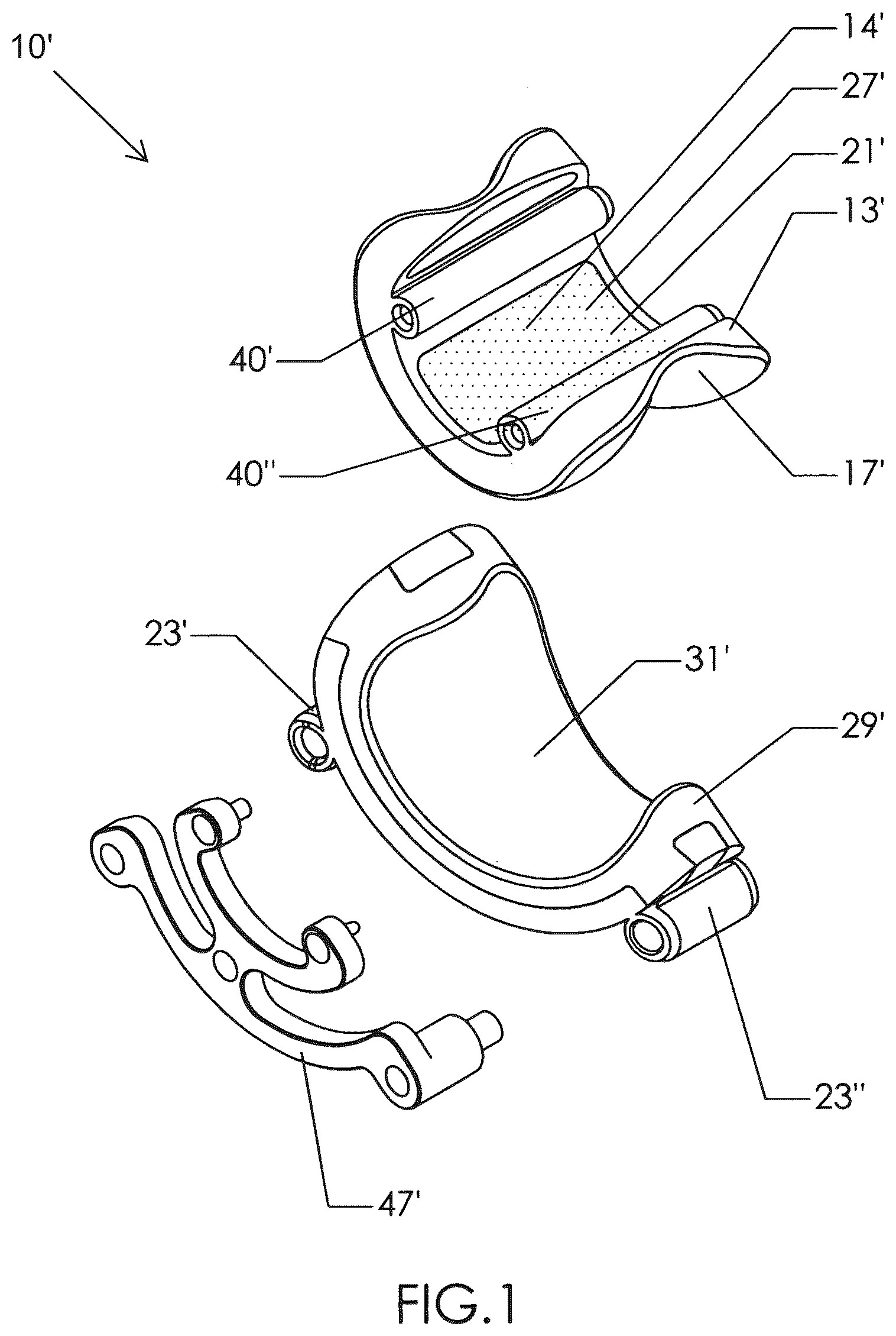 Patent US12310602 — Milling apparatus for implanting a joint prosthesis — Figure 1