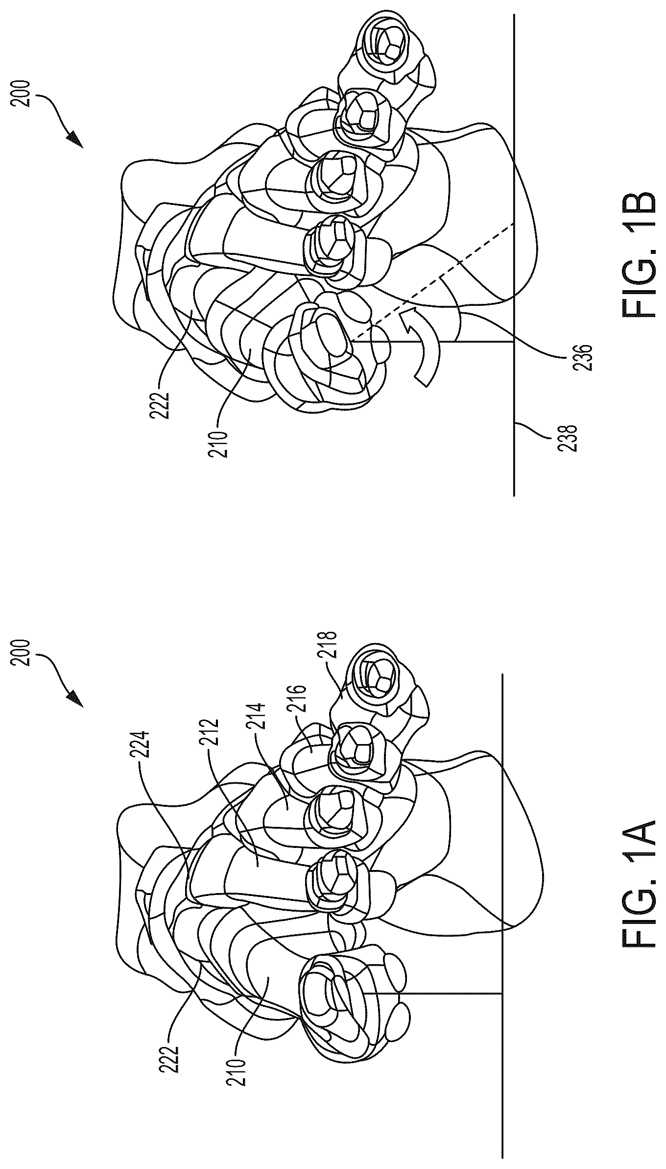 Patent US12310603 — System and technique for metatarsal realignment with reduced incision length — Figure 1