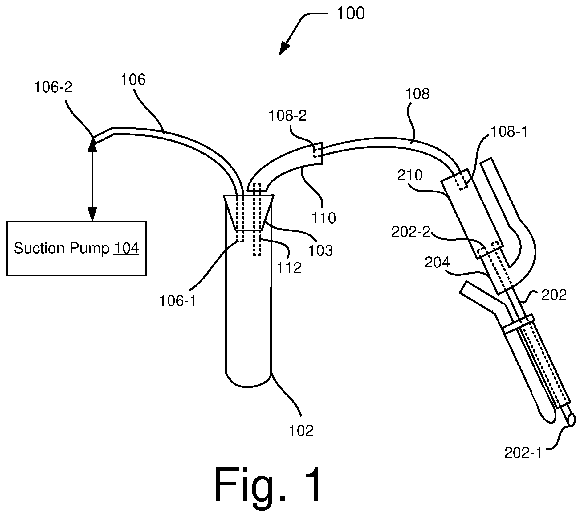 Patent US12310624 — Follicular fluid aspiration — Figure 1