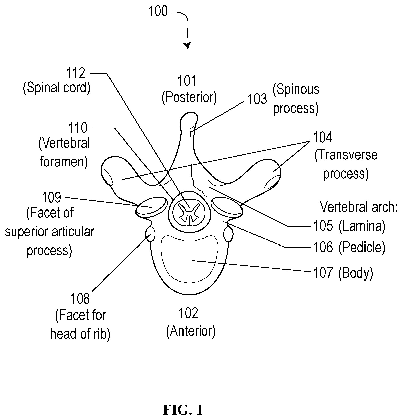 Patent US12310629 Figure 1 – Methods and devices for augmenting the spine
