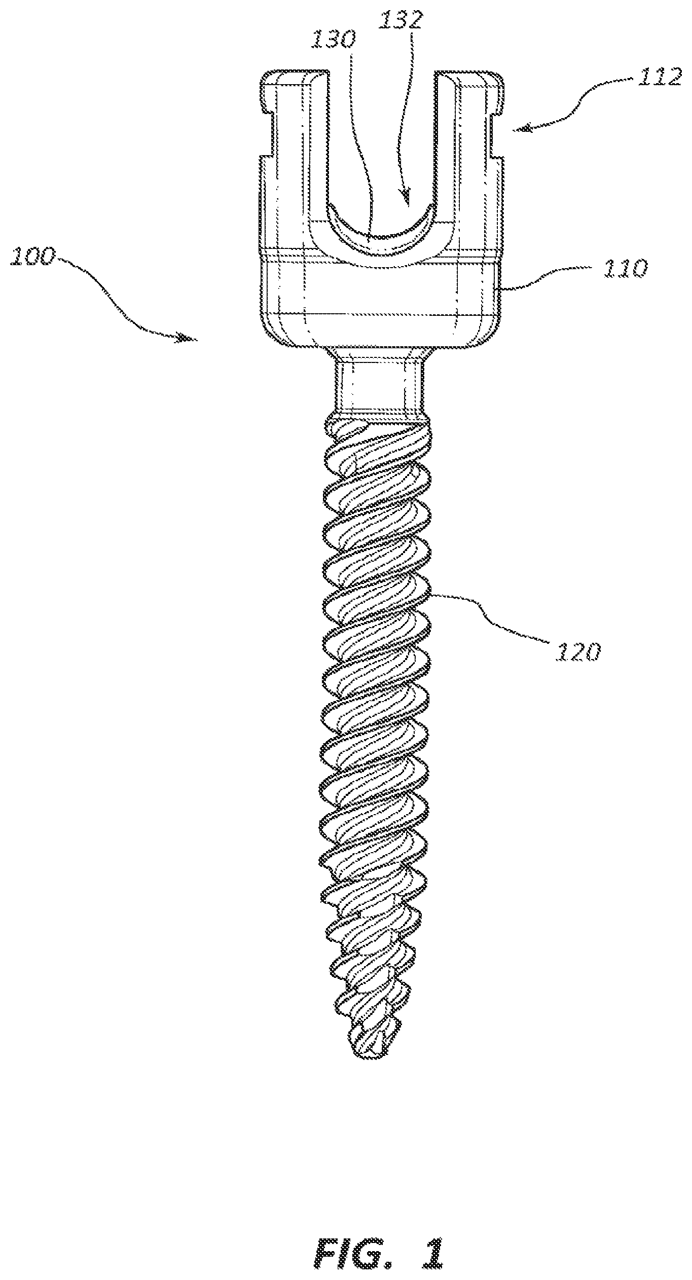 Patent US12310632 — Spring cage spinal fixation systems — Figure 1