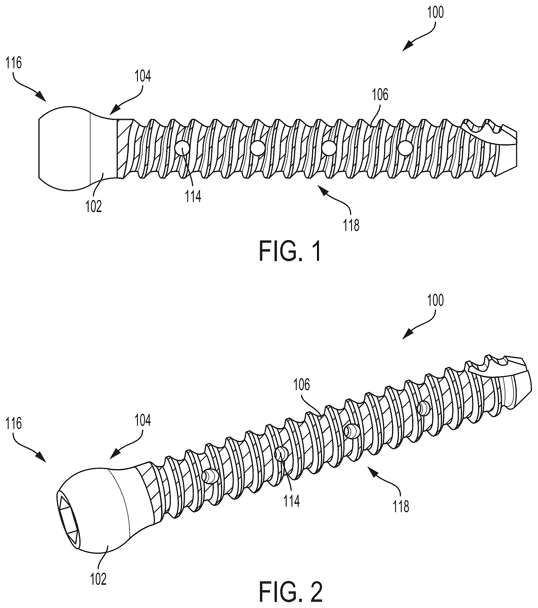 Patent US12310642 — Implant of osteostimulative material — Figure 1