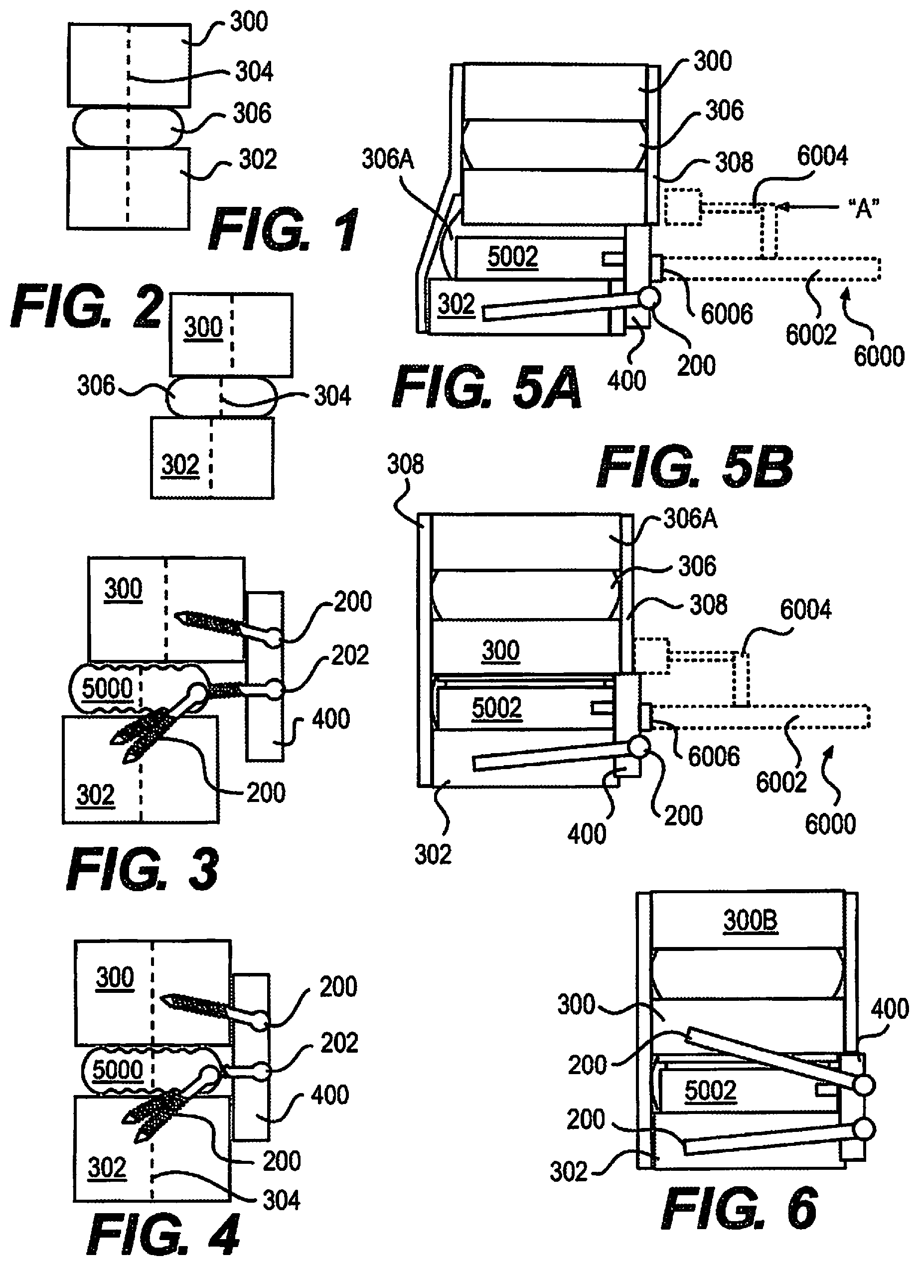 Patent US12310643 — Aligning vertebral bodies — Figure 1