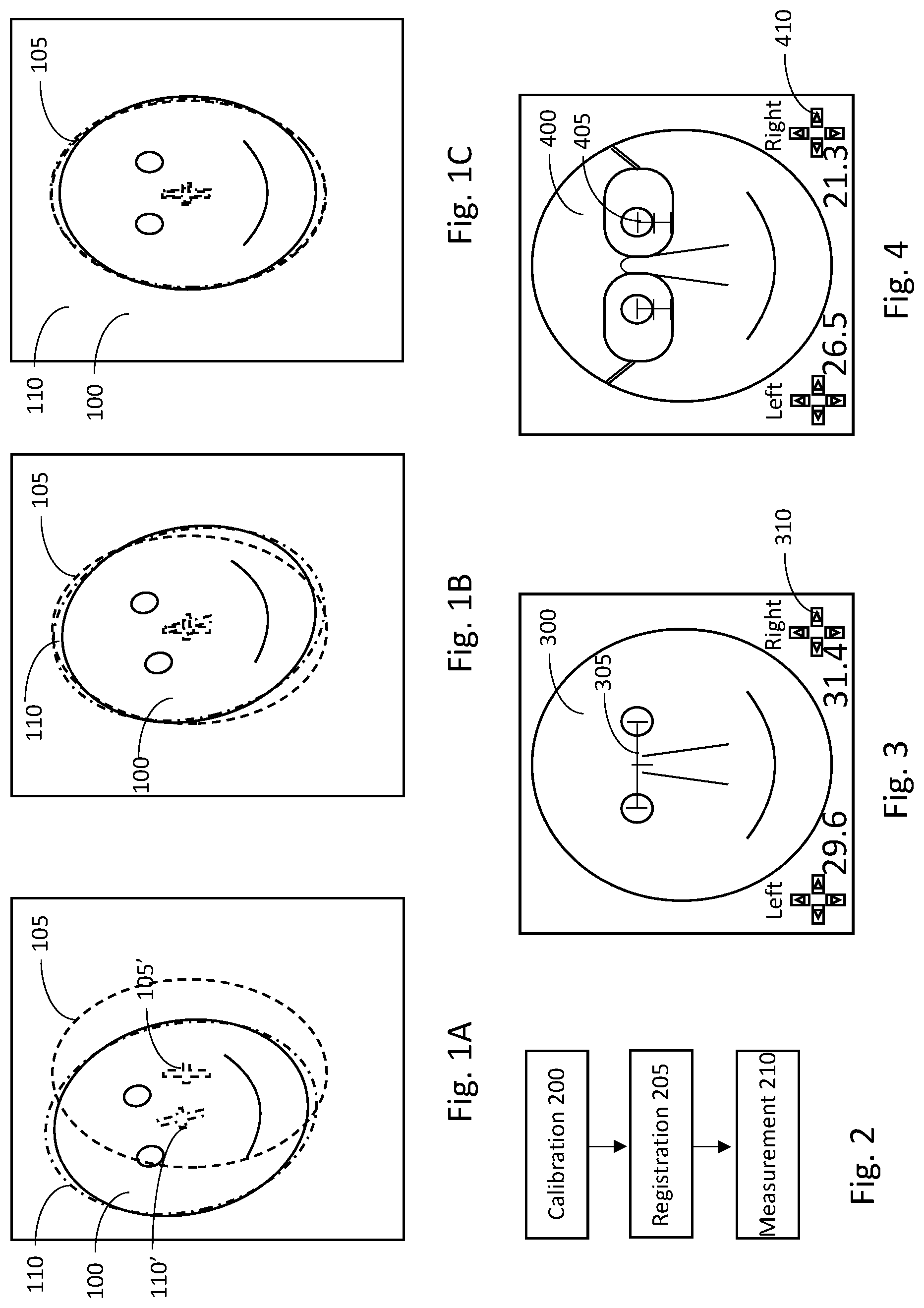 Patent US12310663 — System and method for digital optician measurements — Figure 1