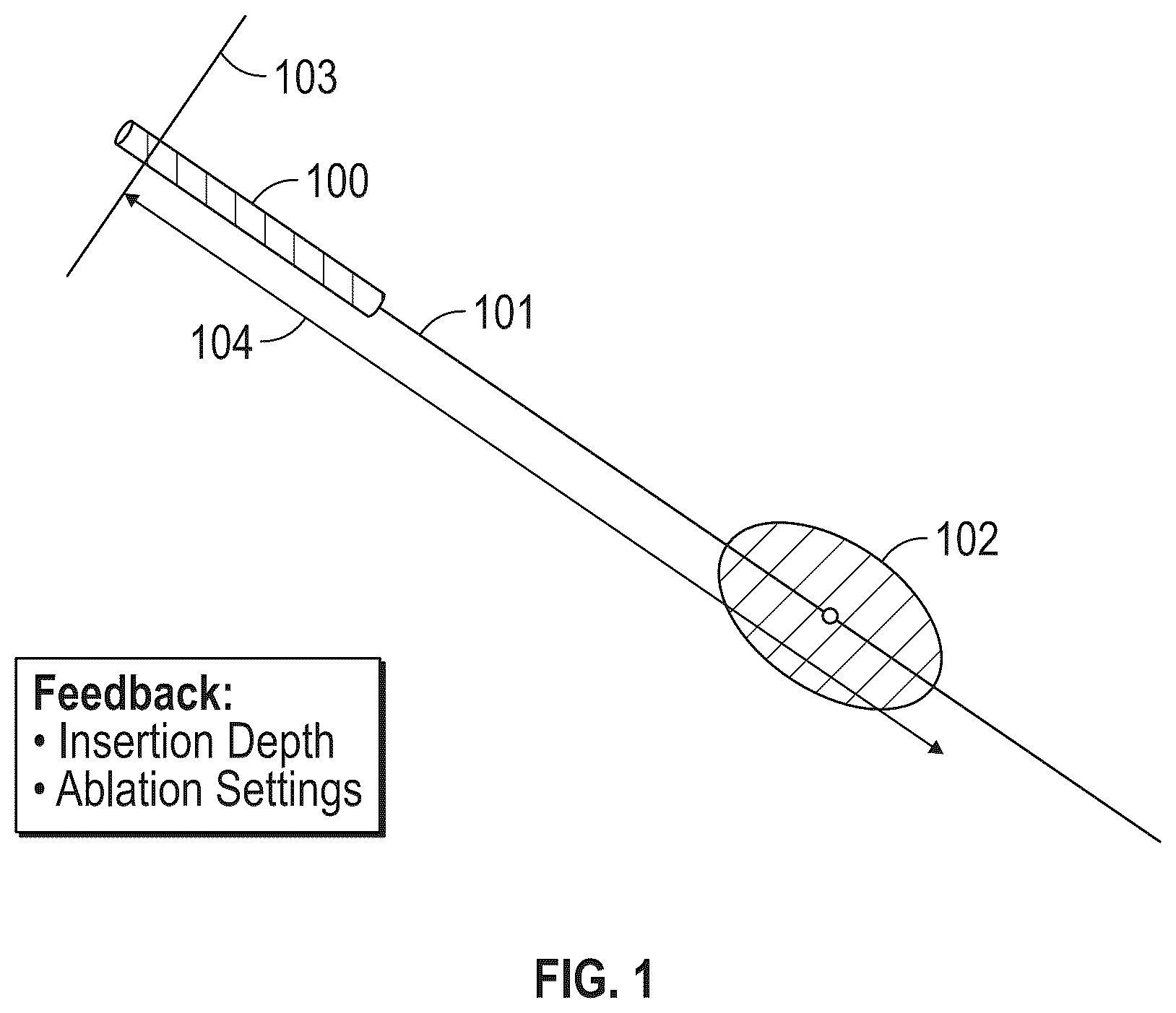 Patent US12310665 — System and method for intra-operative percutaneous ablation planning — Figure 1