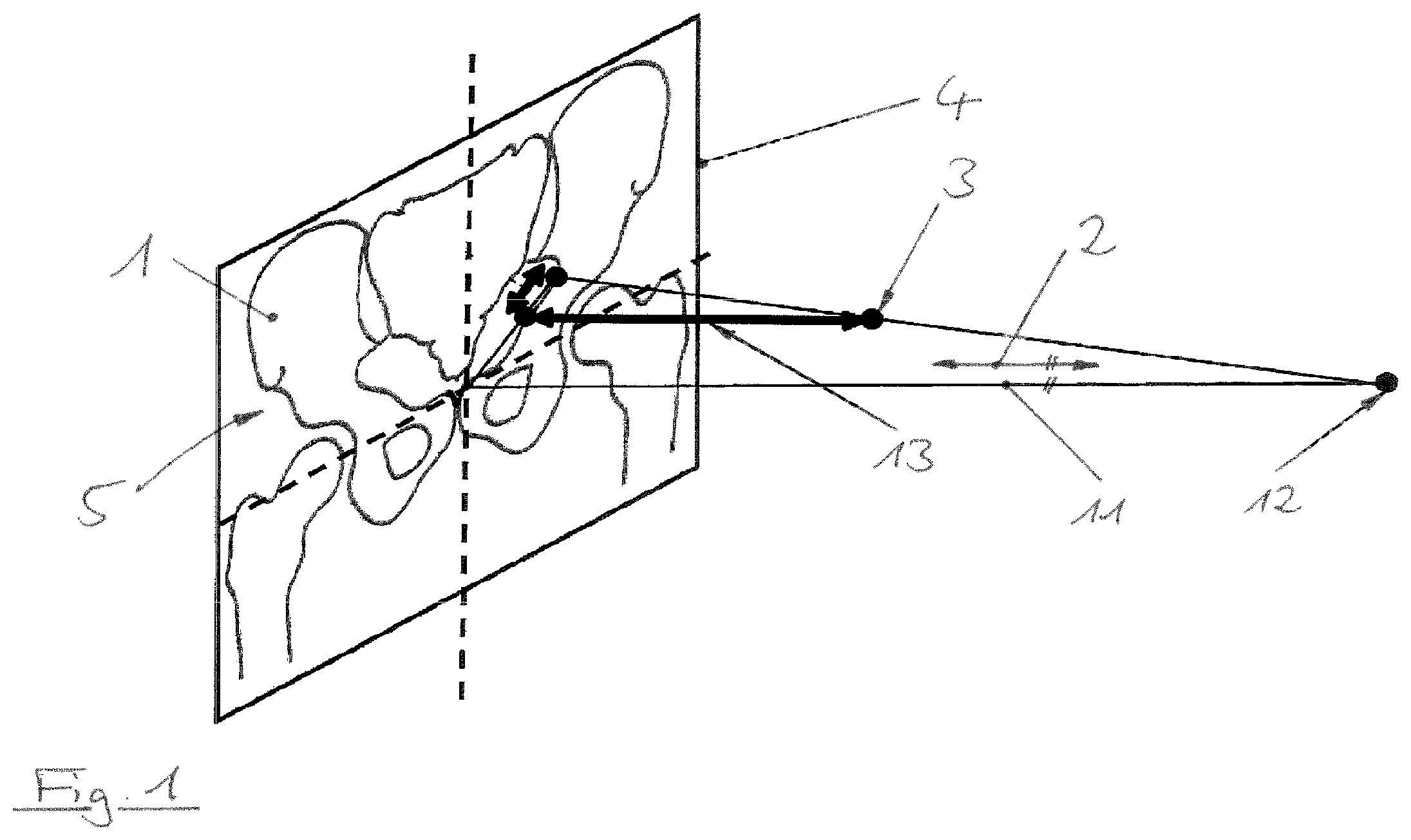 Patent US12310667 — Sagittal rotation determination — Figure 1