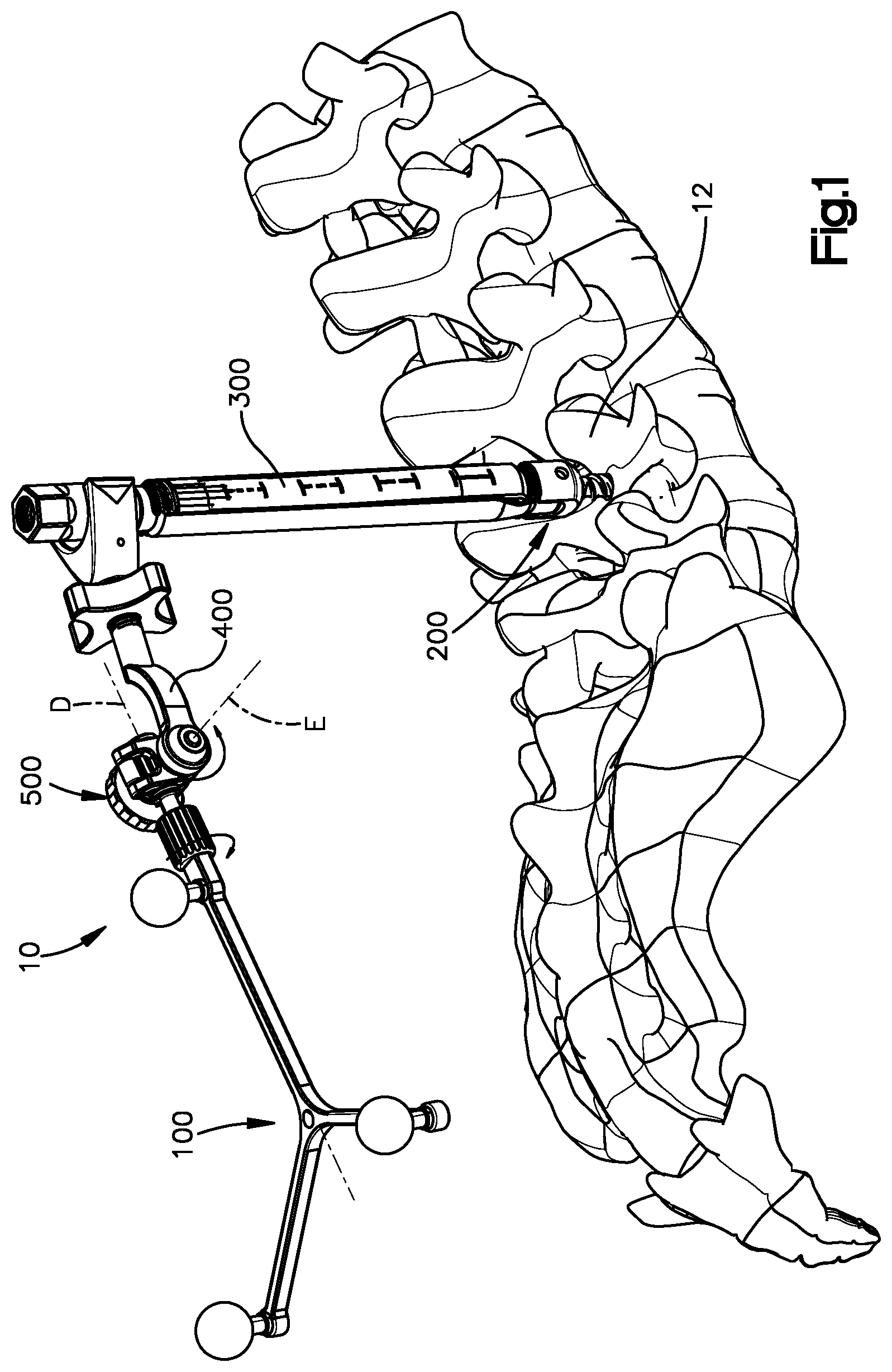 Patent US12310672 — Assembly for coupling a patient reference array to a medical implant such as a pedicle screw — Figure 1
