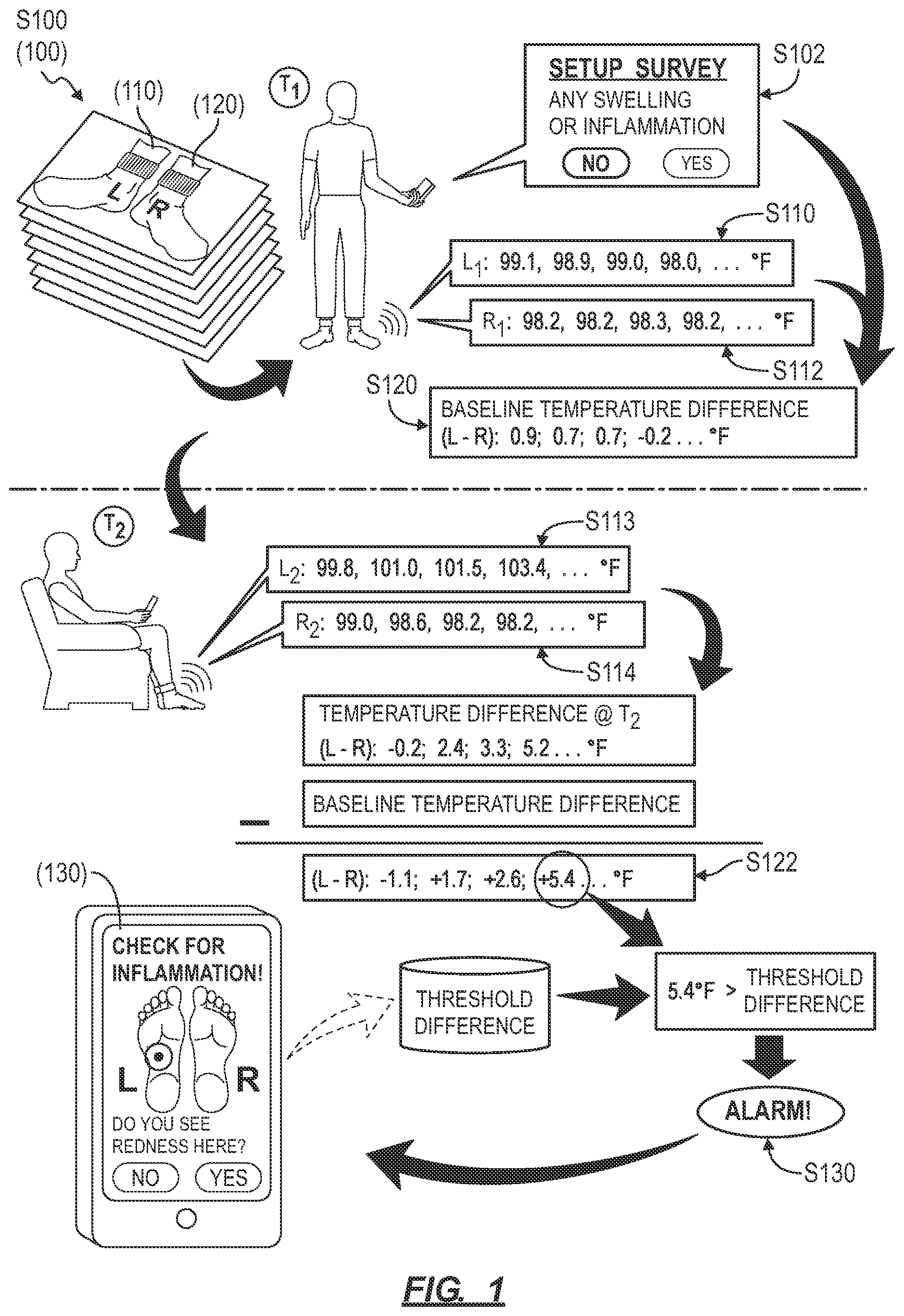 Patent US12310700 — System and method for detecting inflammation in a foot — Figure 1