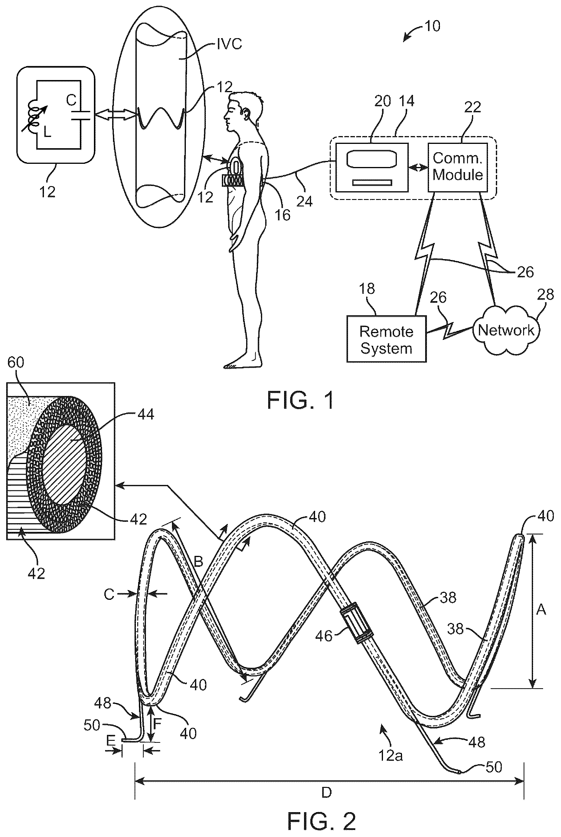 Patent US12310707 — Wireless resonant circuit and variable inductance vascular monitoring implants and anchoring structures therefore — Figure 1