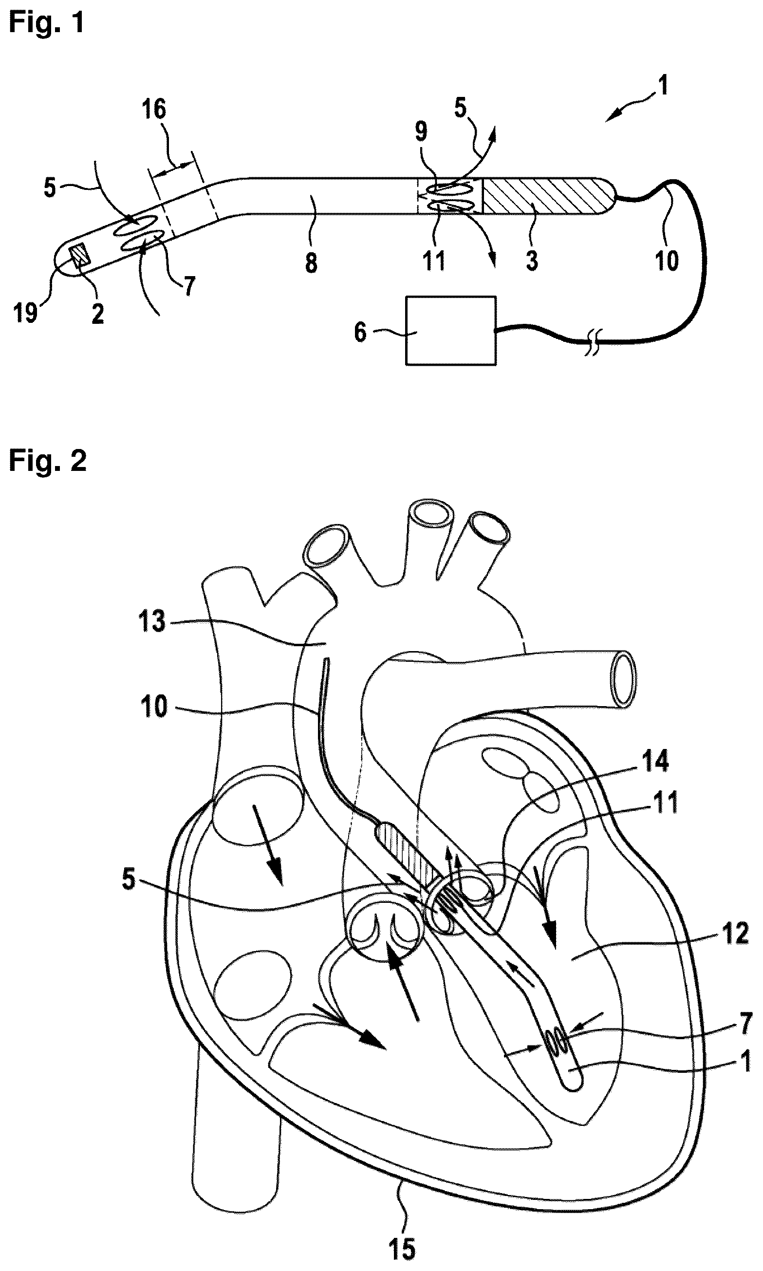 Patent US12310708 — Systems and methods for determining a flow speed of a fluid flowing through a cardiac assist device — Figure 1