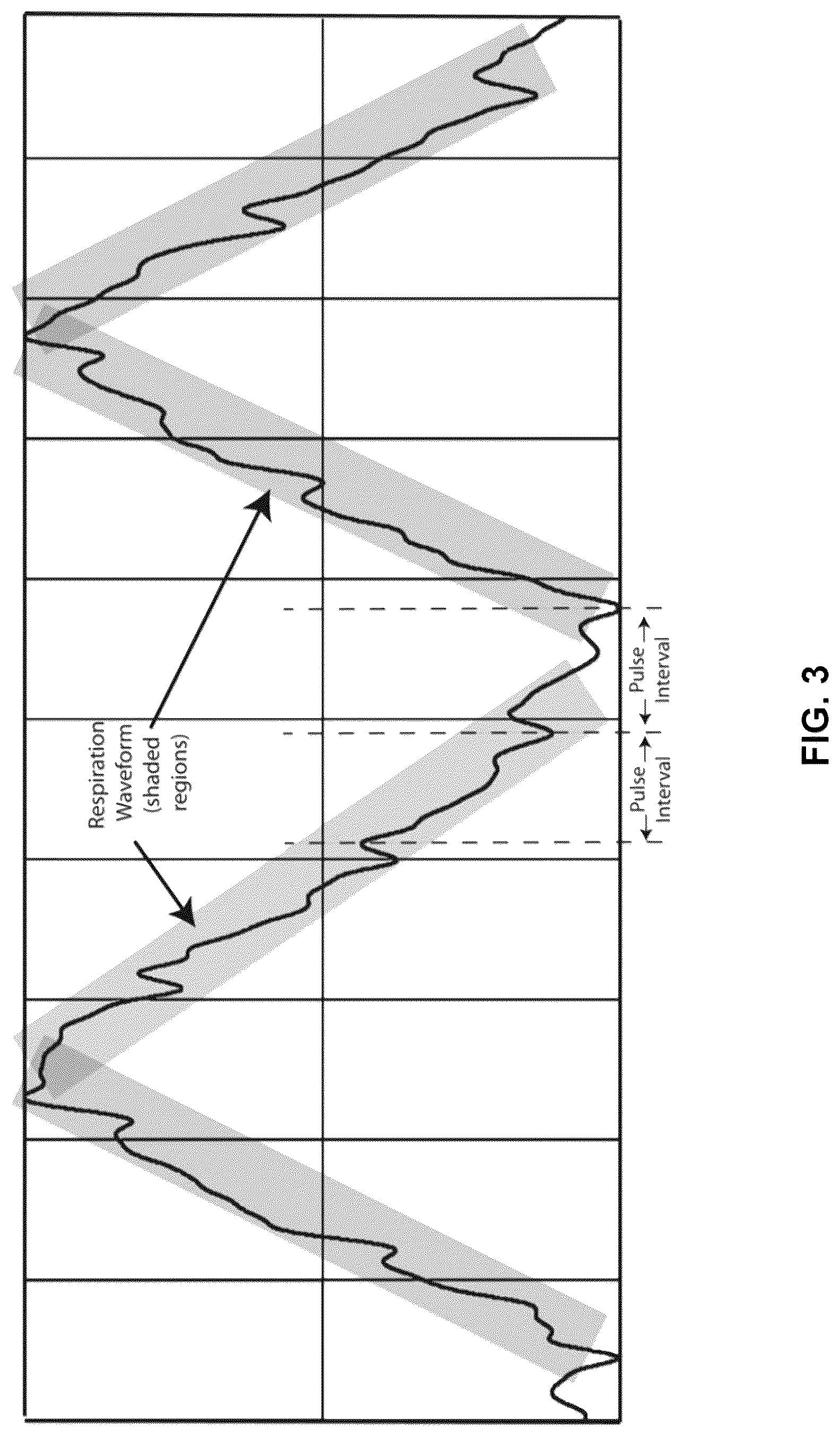 Patent US12310710 Figure 3 – Computation of parameters of a body using an electric field