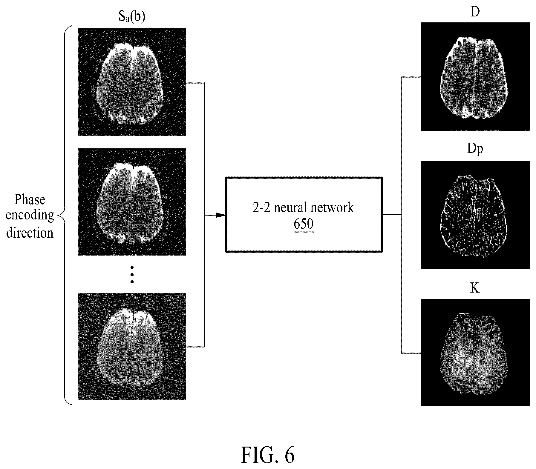 Patent US12310713 Figure 6 – Method of quantifying magnetic resonance diffusion parameters by using diffusion weighted magnetic resonance images