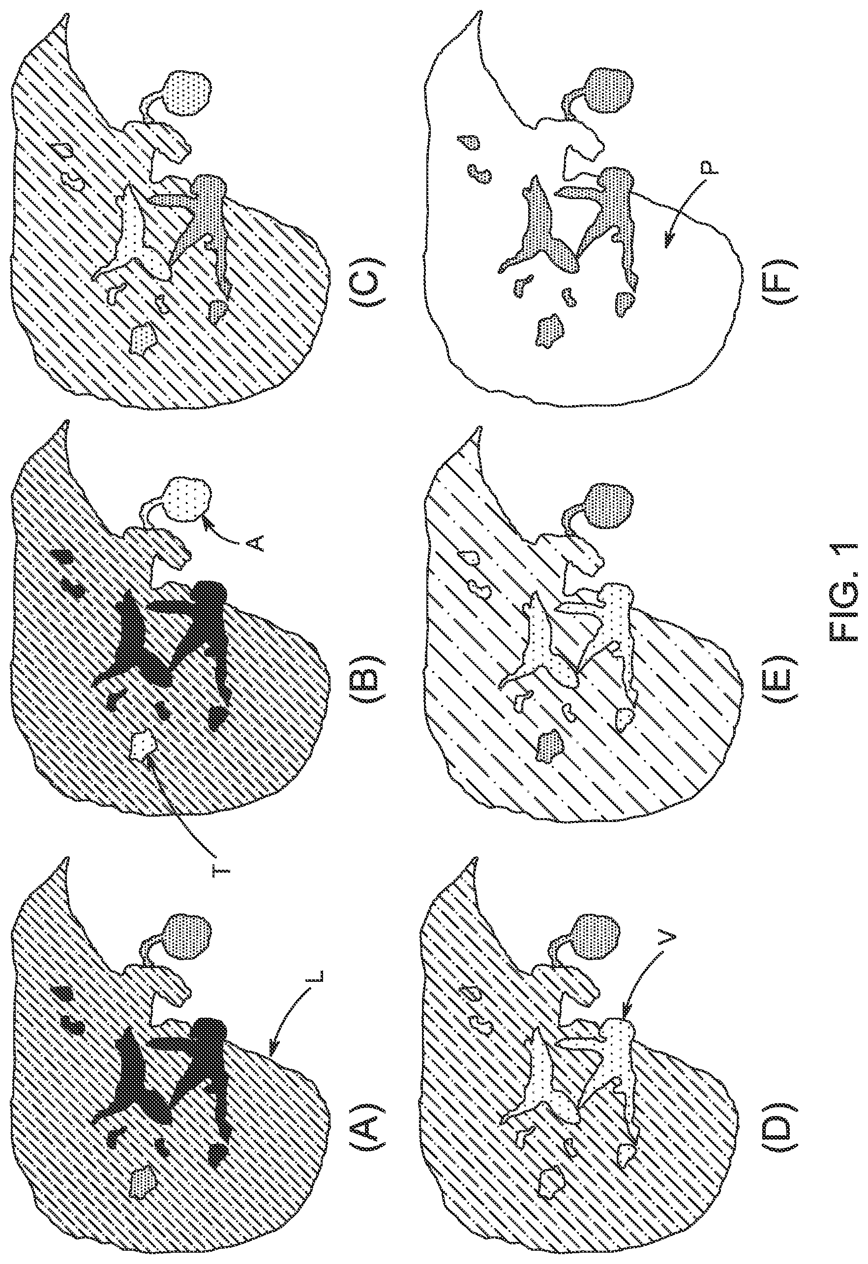 Patent US12310741 — Generation of MRI images of the liver — Figure 1