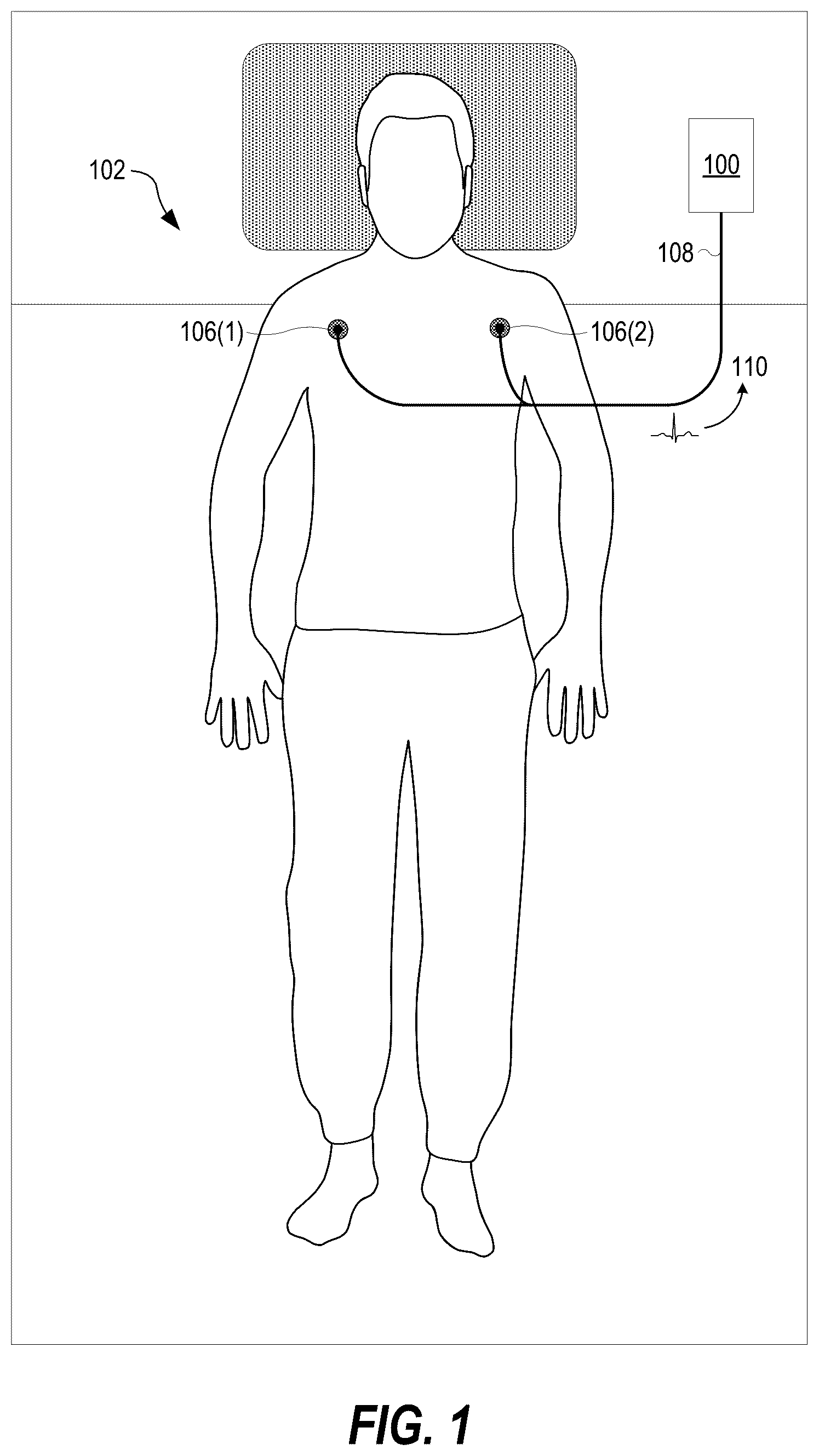 Patent US12310758 — Neural-network based electrocardiogramy monitor and associated methods — Figure 1
