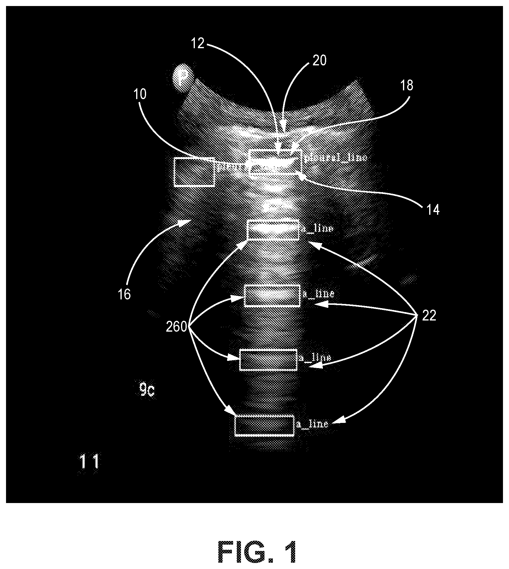 Patent US12310783 — Automated ultrasound video interpretation of a body part with one or more convolutional neural networks — Figure 1
