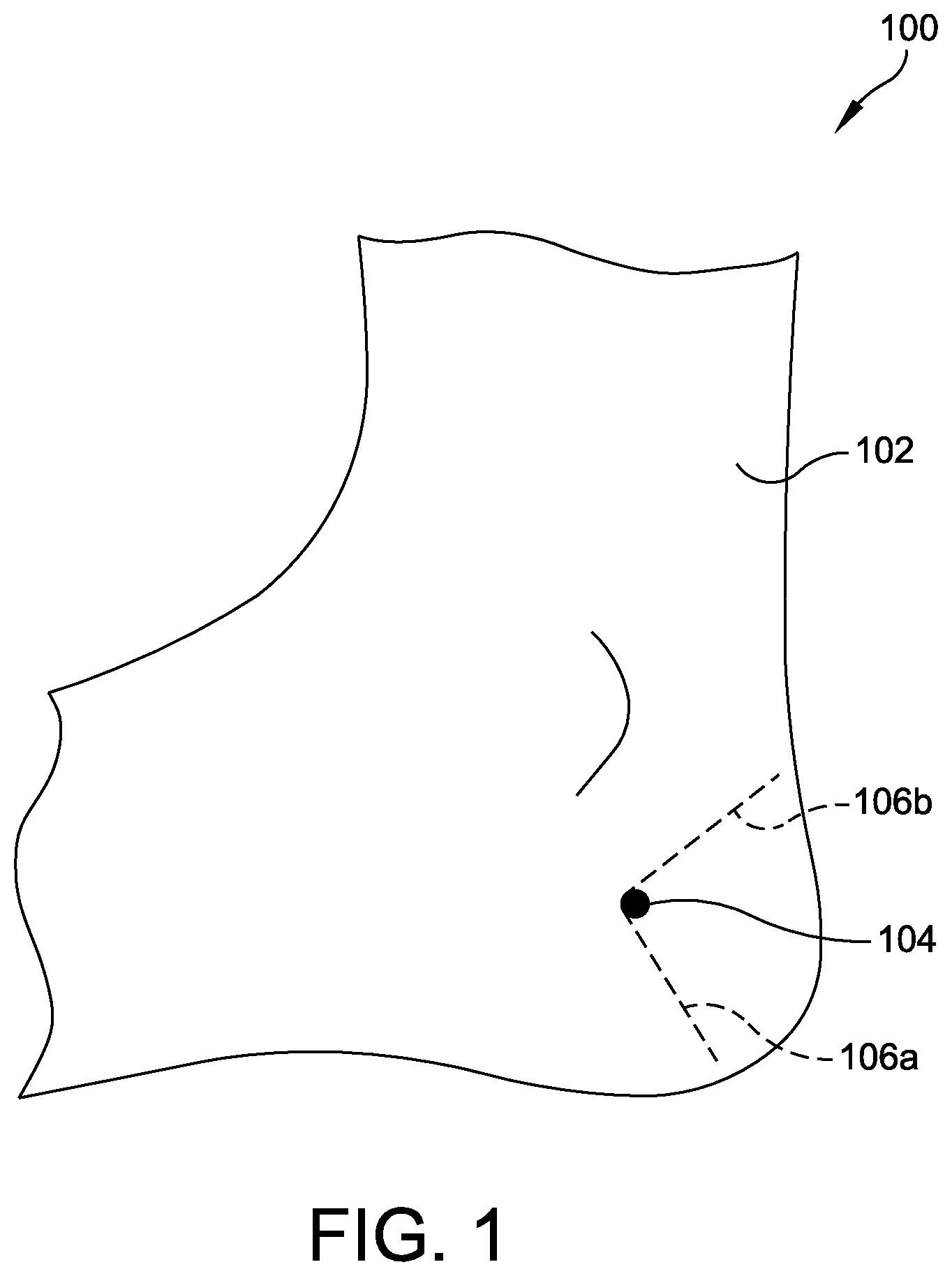 Patent US12310799 — Minimally invasive surgery laser guide — Figure 1