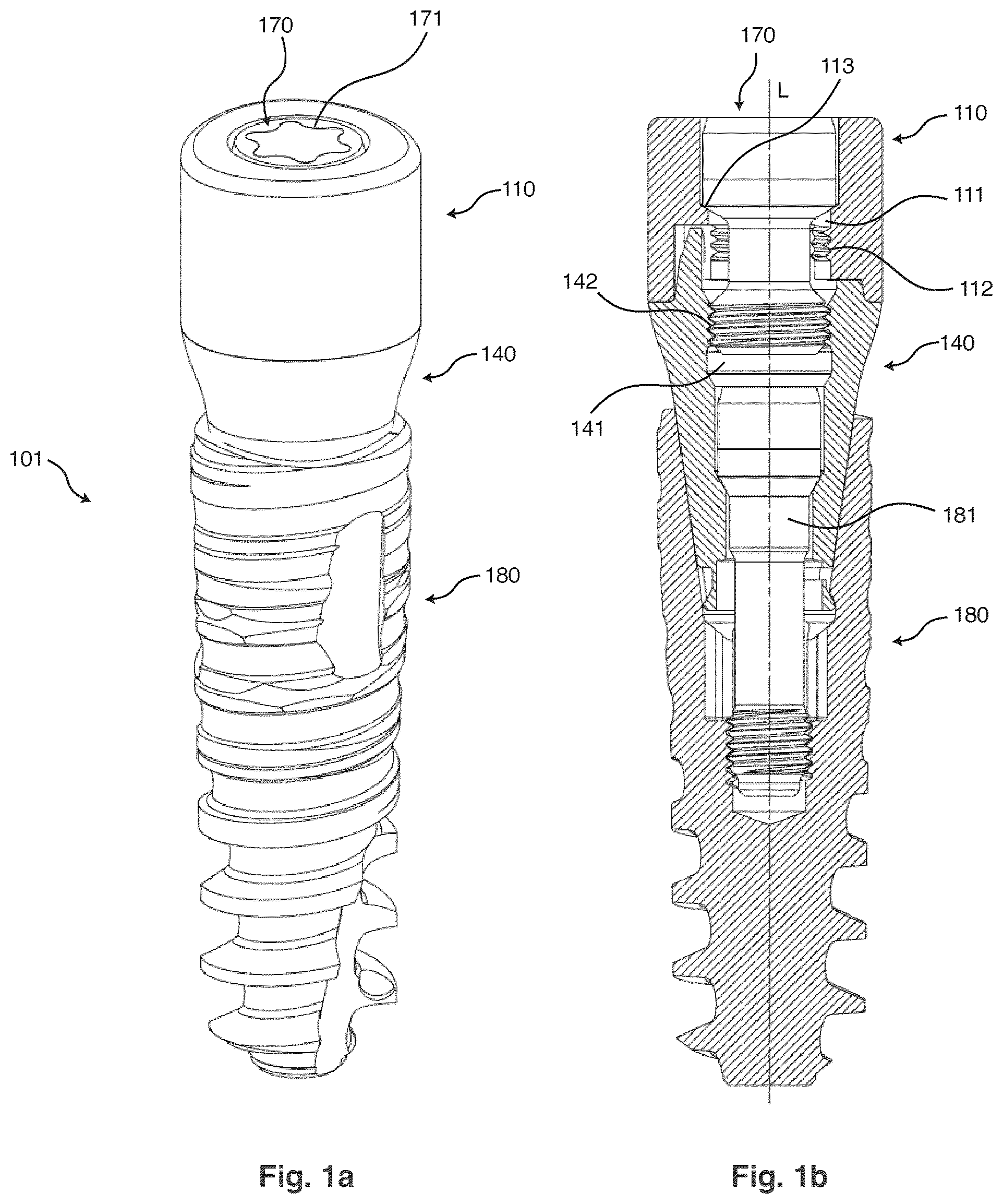 Patent US12310806 — Dental component with an interface — Figure 1