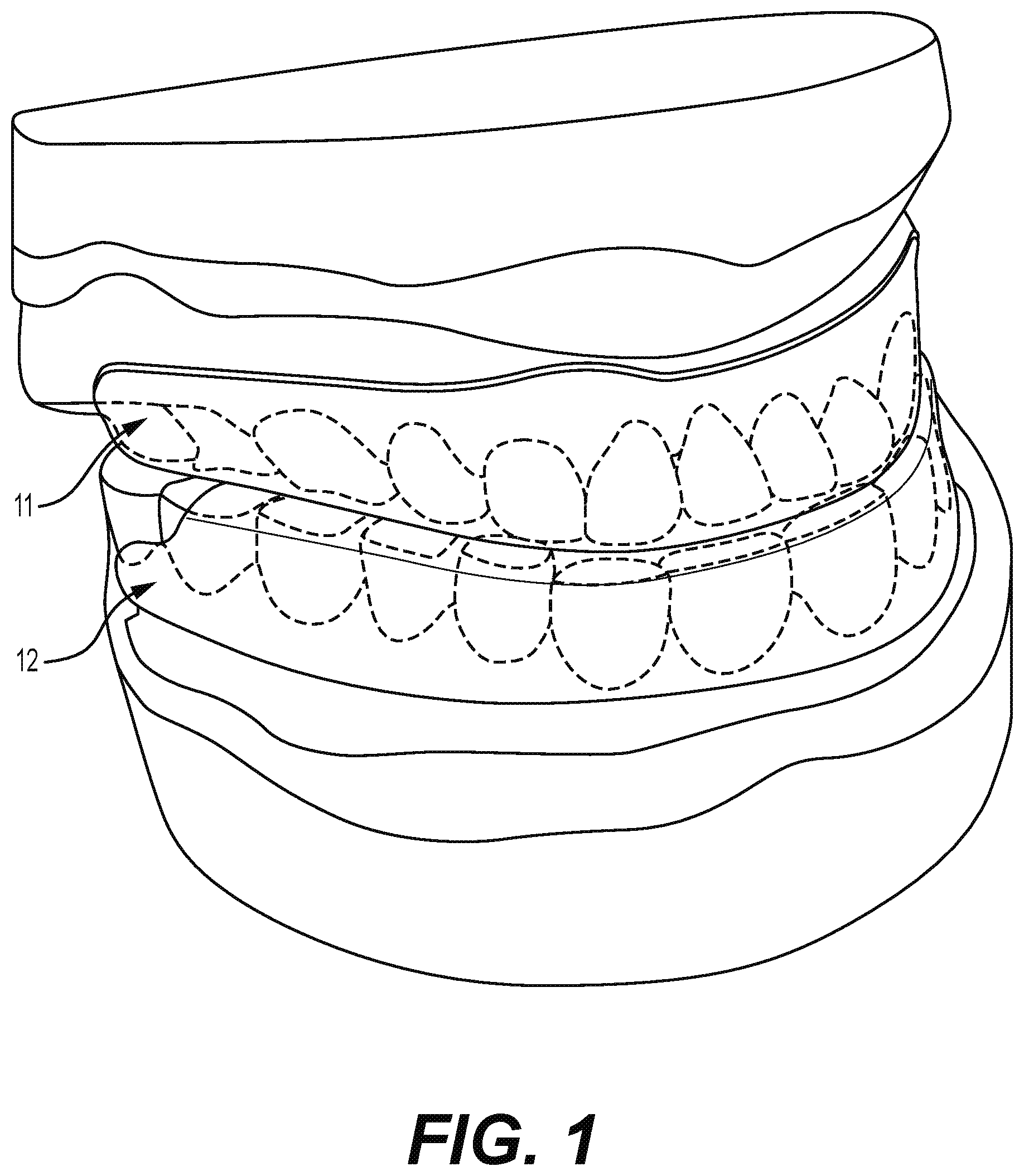 Patent US12310812 Figure 1 – Multifunctional oral appliance