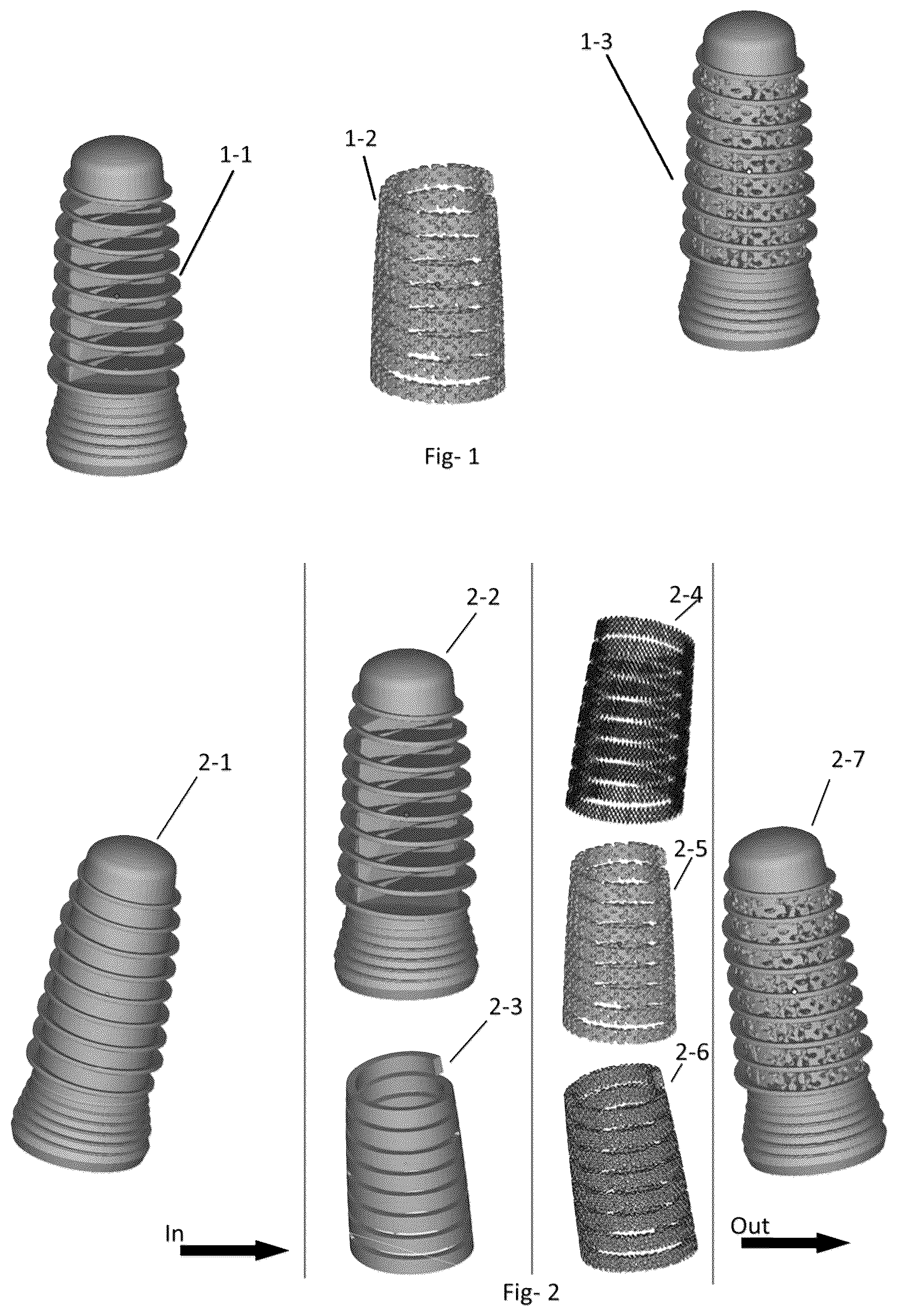 Patent US12310815 — Dental implant and self-locking fastening element with heterogeneousporous structures, and method for its production — Figure 1