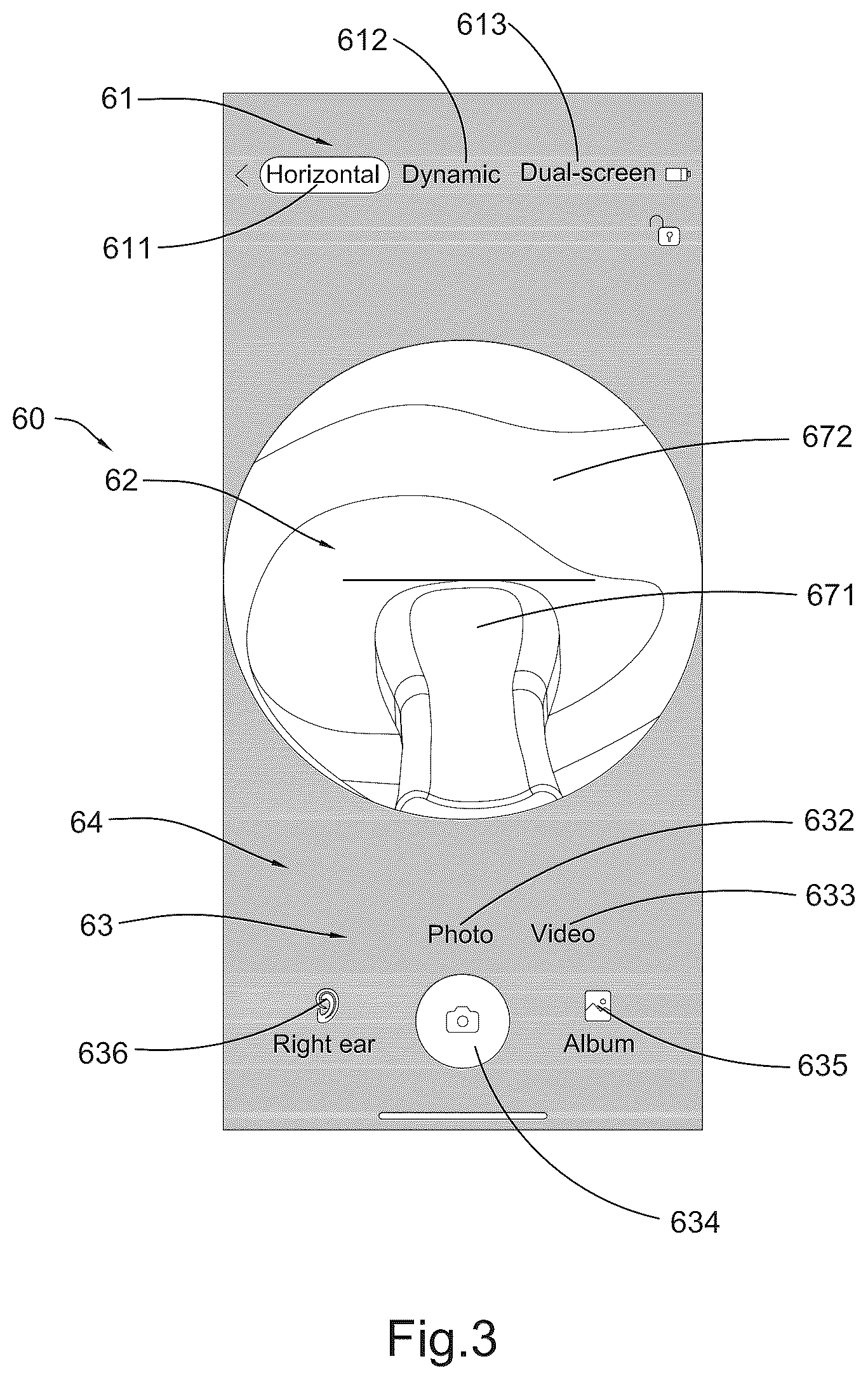 Patent US12310820 Figure 5 – Image processing method and operation interface for ear cleaning arrangement