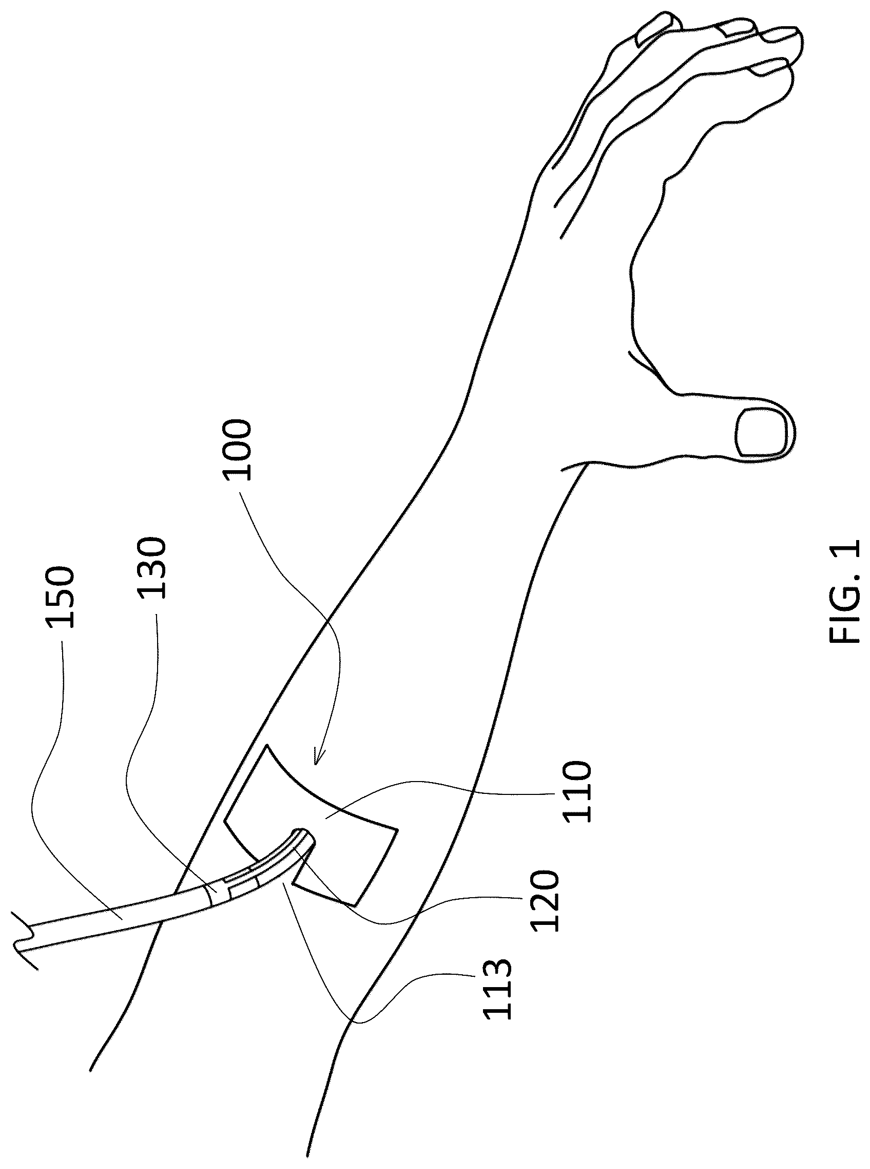 Patent US12310824 — Surgical dressing for drains — Figure 1