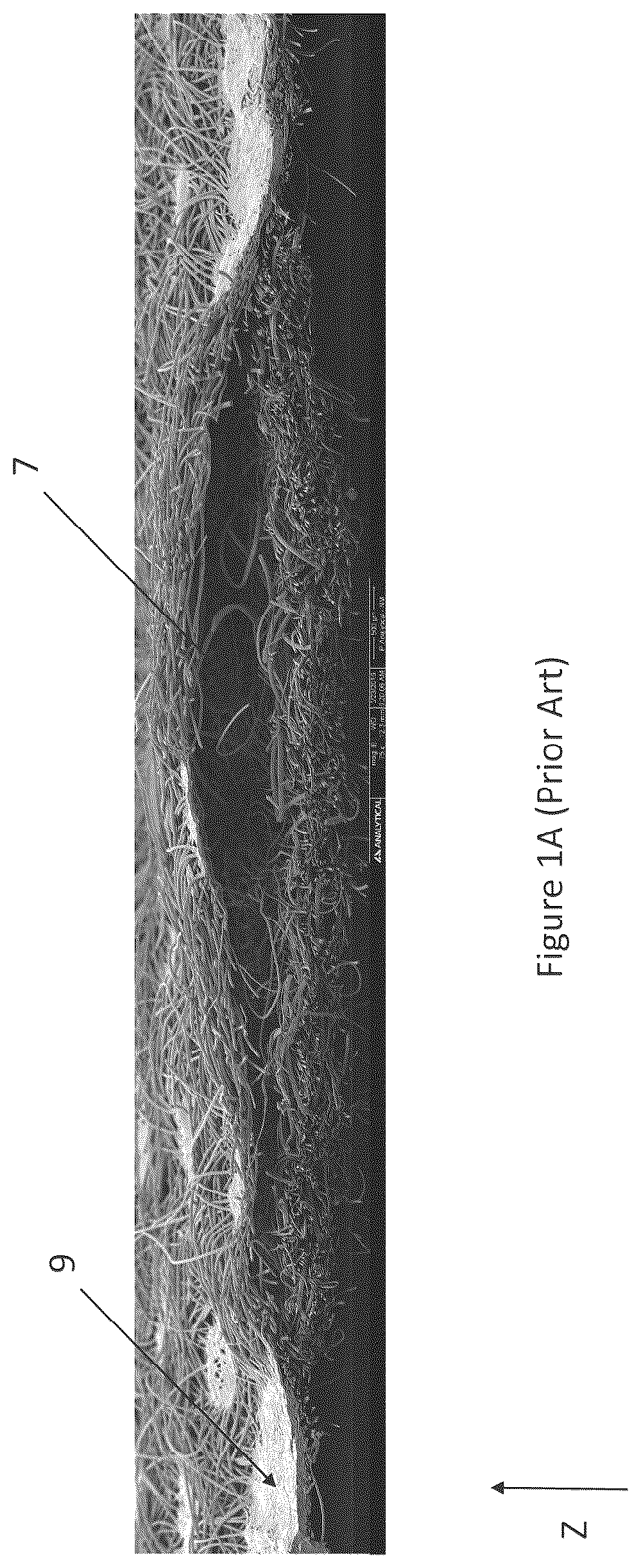 Patent US12310825 — Absorbent article with conforming features — Figure 1