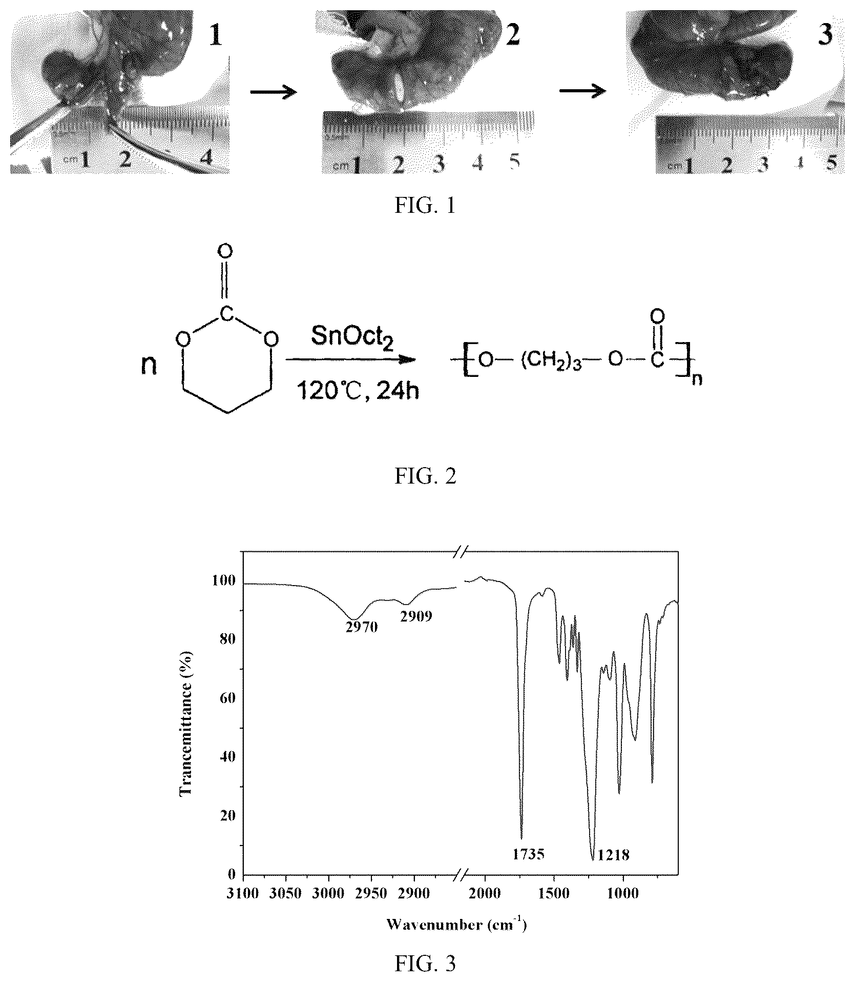 Patent US12310834 — PTMC-based intestinal anastomosis stent of bioabsorbable flexible elastomer and preparation method therefor — Figure 1