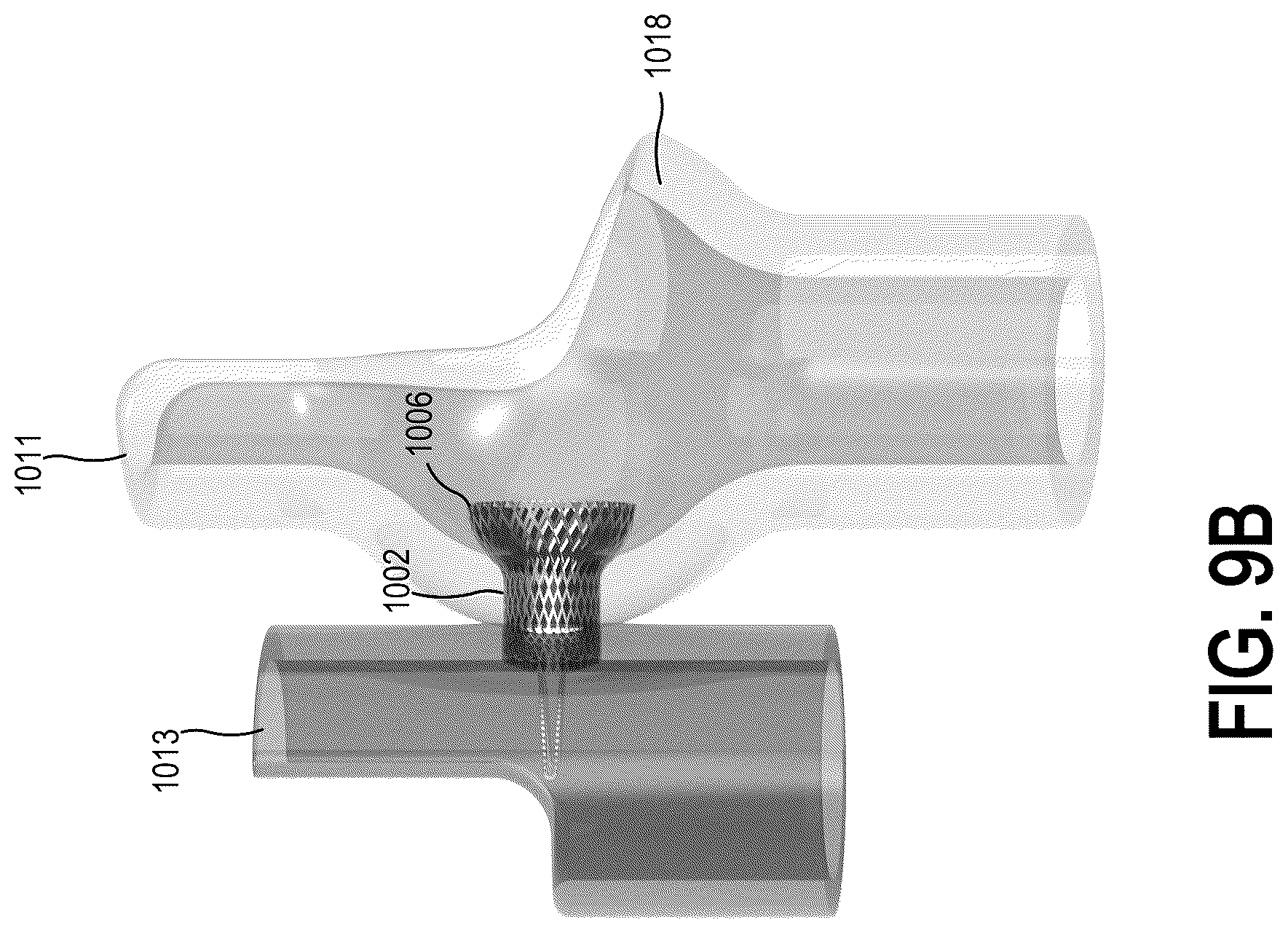 Patent US12310837 Figure 16 – Methods and systems for transcaval treatment of aneurysms
