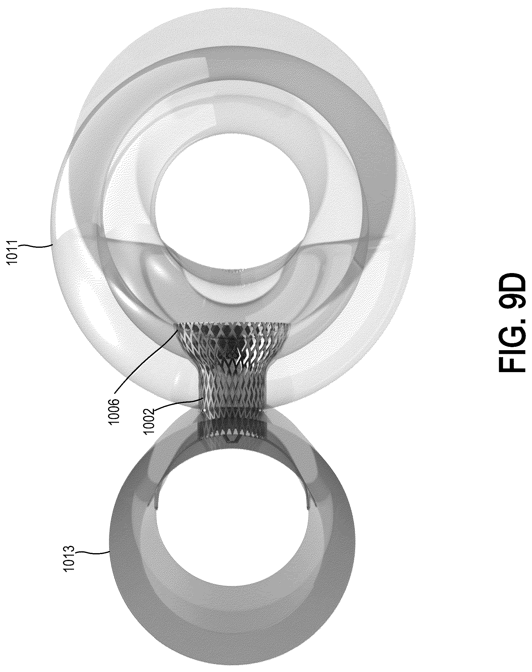 Patent US12310837 Figure 18 – Methods and systems for transcaval treatment of aneurysms