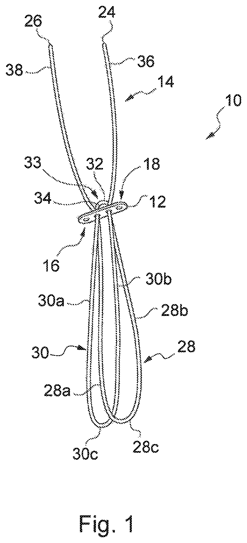 Patent US12310840 — Implant assembly and associated methods of manufacturing — Figure 1