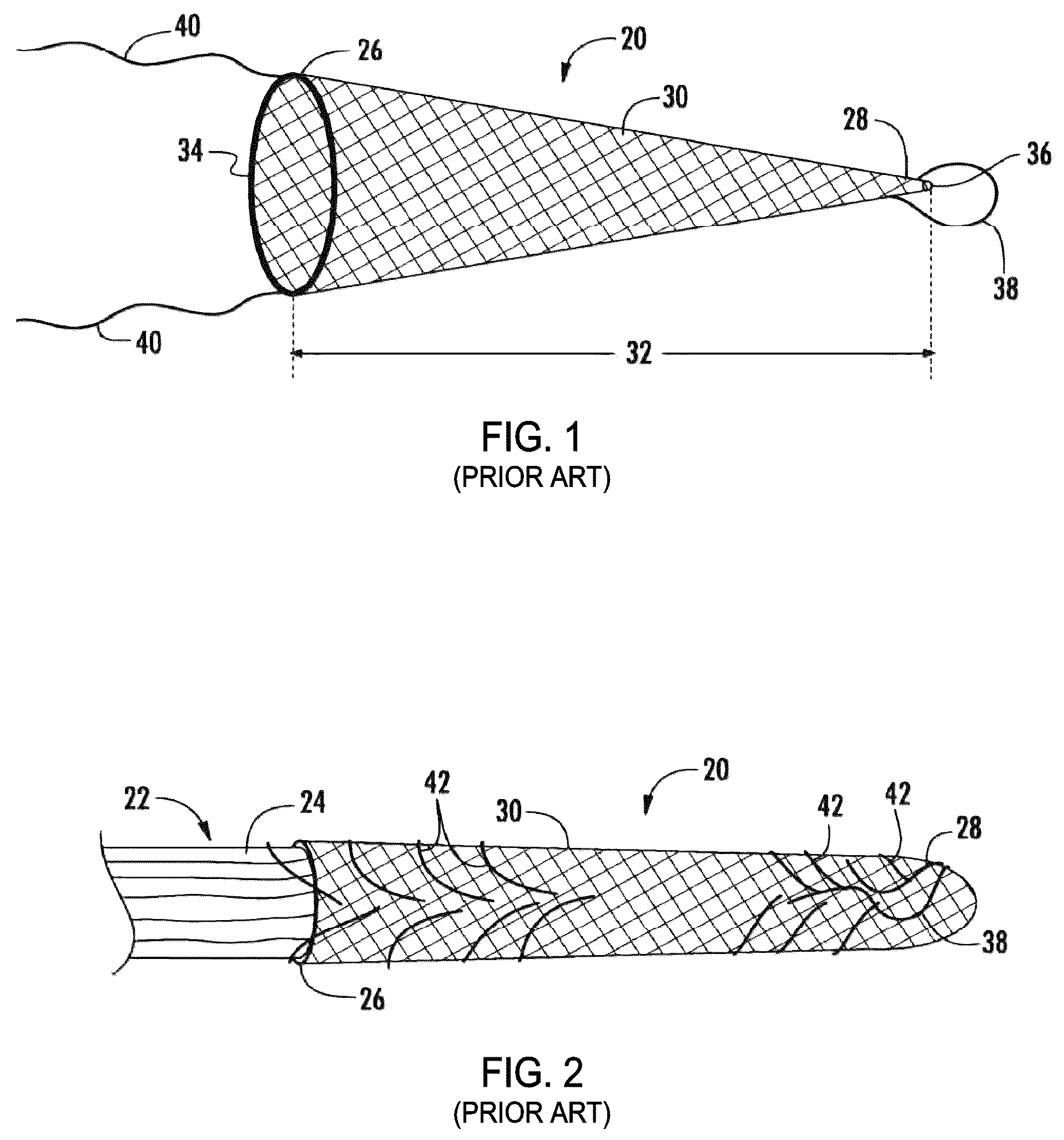 Patent US12310841 Figure 1 – Fibrous connective tissue protective device, method of manufacturing, and surgical method