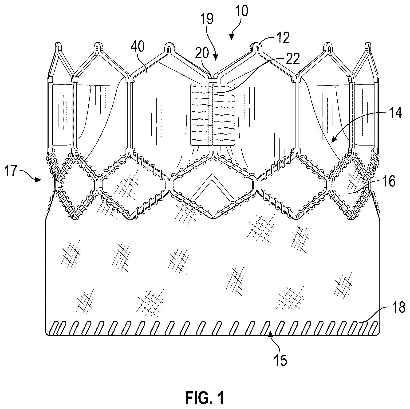 Patent US12310843 Figure 1 – Balloon cover for a delivery apparatus for an expandable prosthetic heart valve
