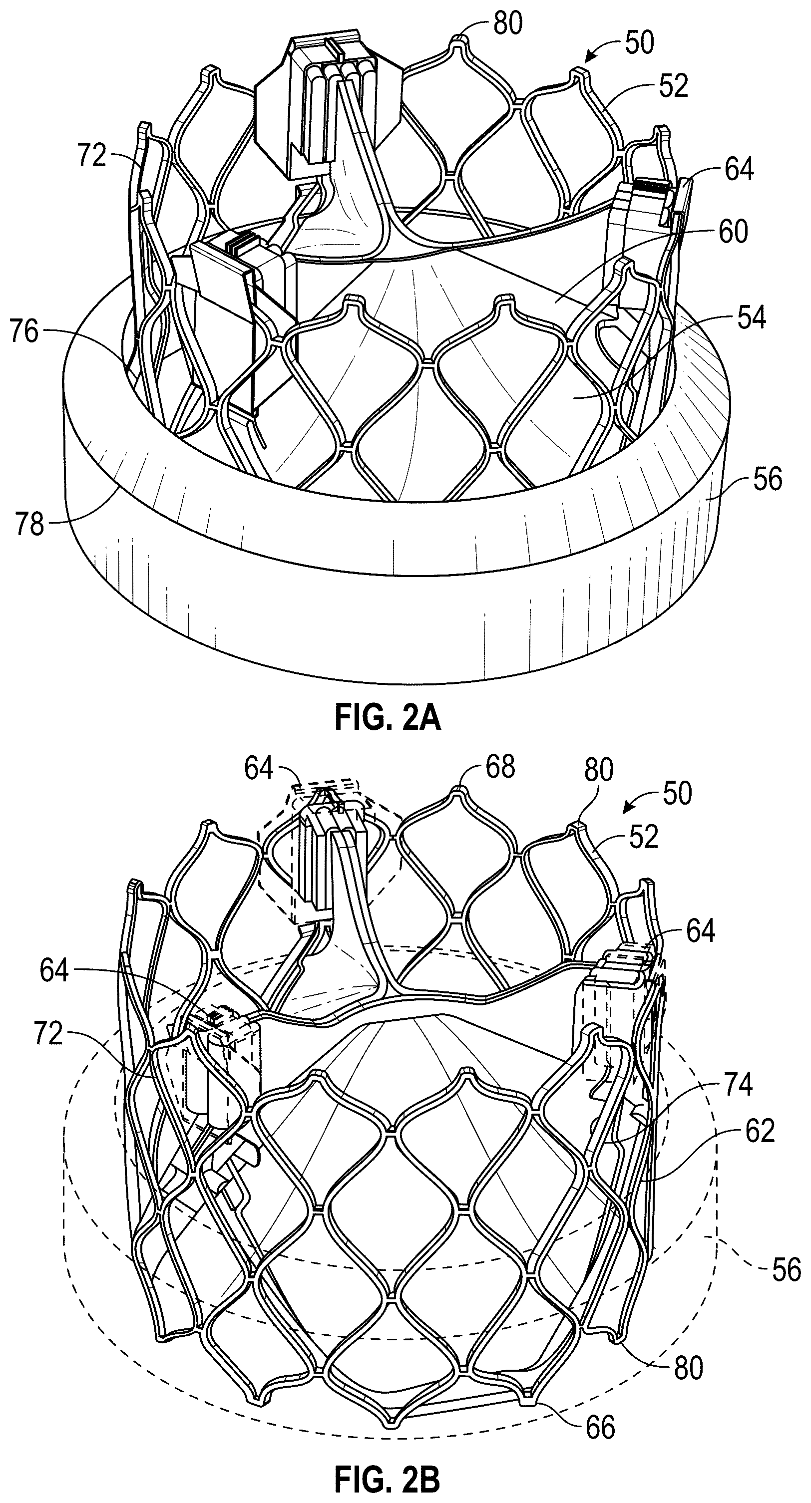 Patent US12310843 Figure 2 – Balloon cover for a delivery apparatus for an expandable prosthetic heart valve