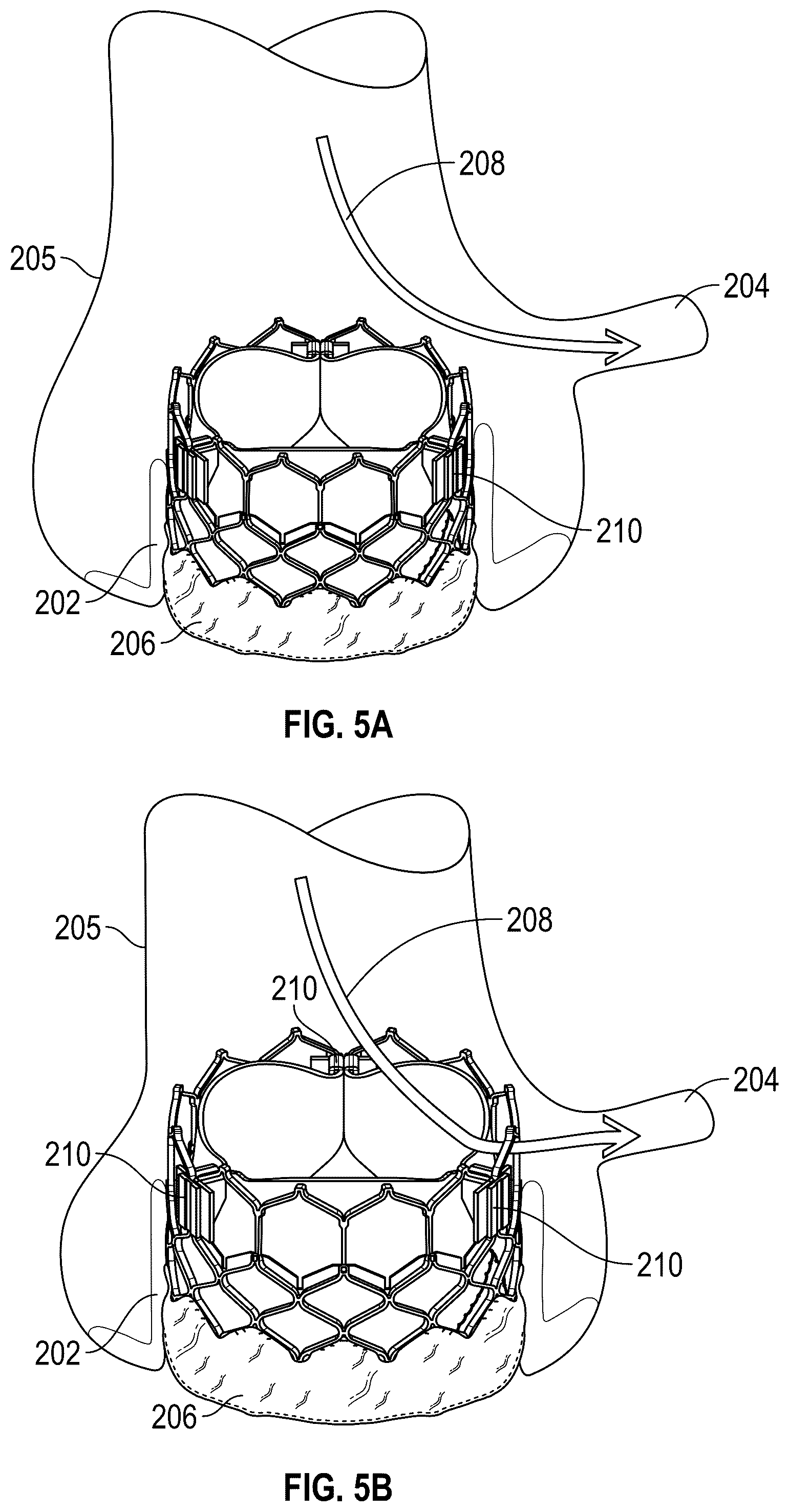 Patent US12310843 Figure 4 – Balloon cover for a delivery apparatus for an expandable prosthetic heart valve