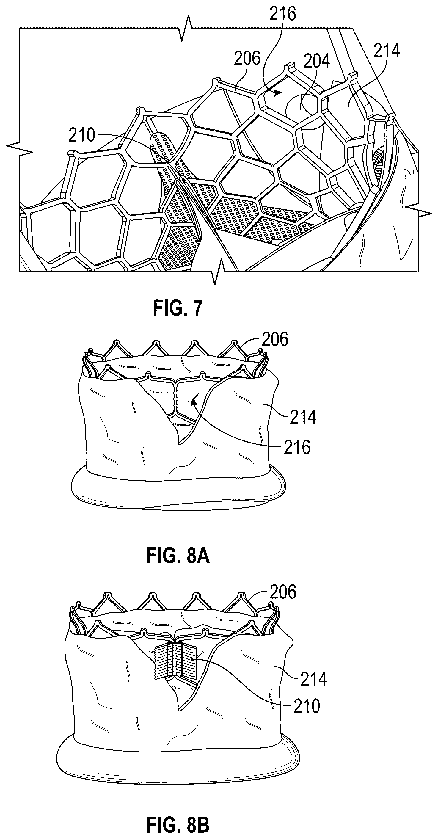 Patent US12310843 Figure 6 – Balloon cover for a delivery apparatus for an expandable prosthetic heart valve