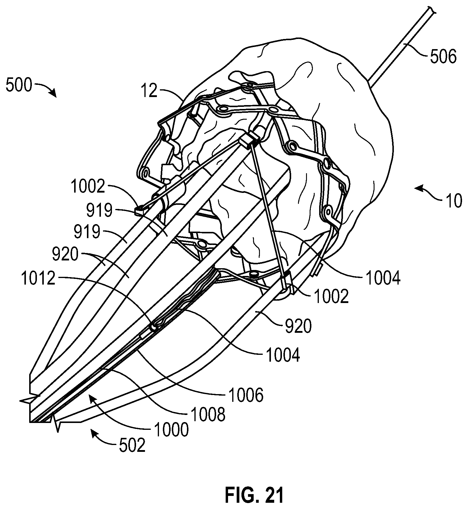 Patent US12310847 Figure 18 – Prosthetic heart valve having non-cylindrical frame