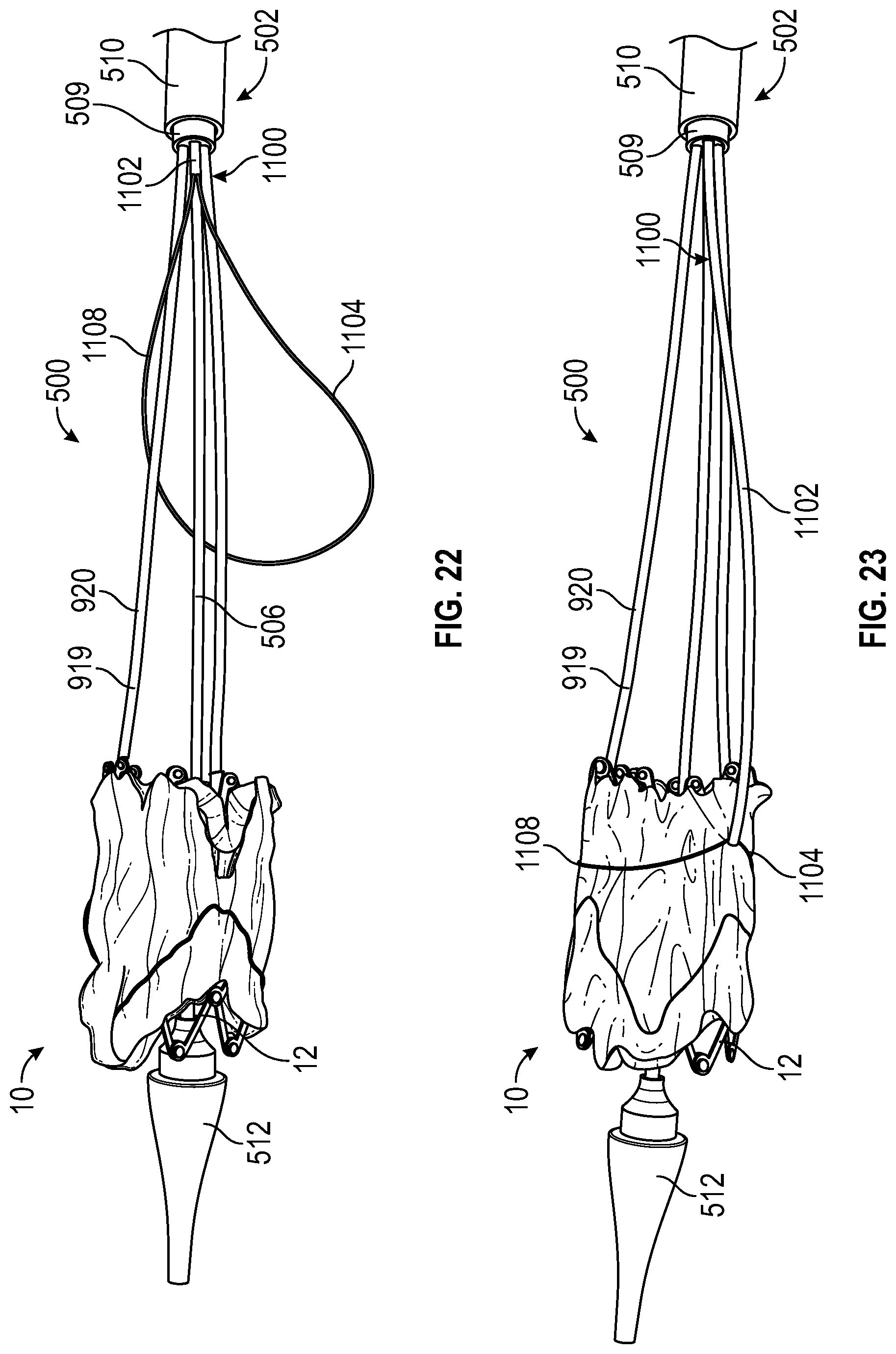 Patent US12310847 Figure 19 – Prosthetic heart valve having non-cylindrical frame