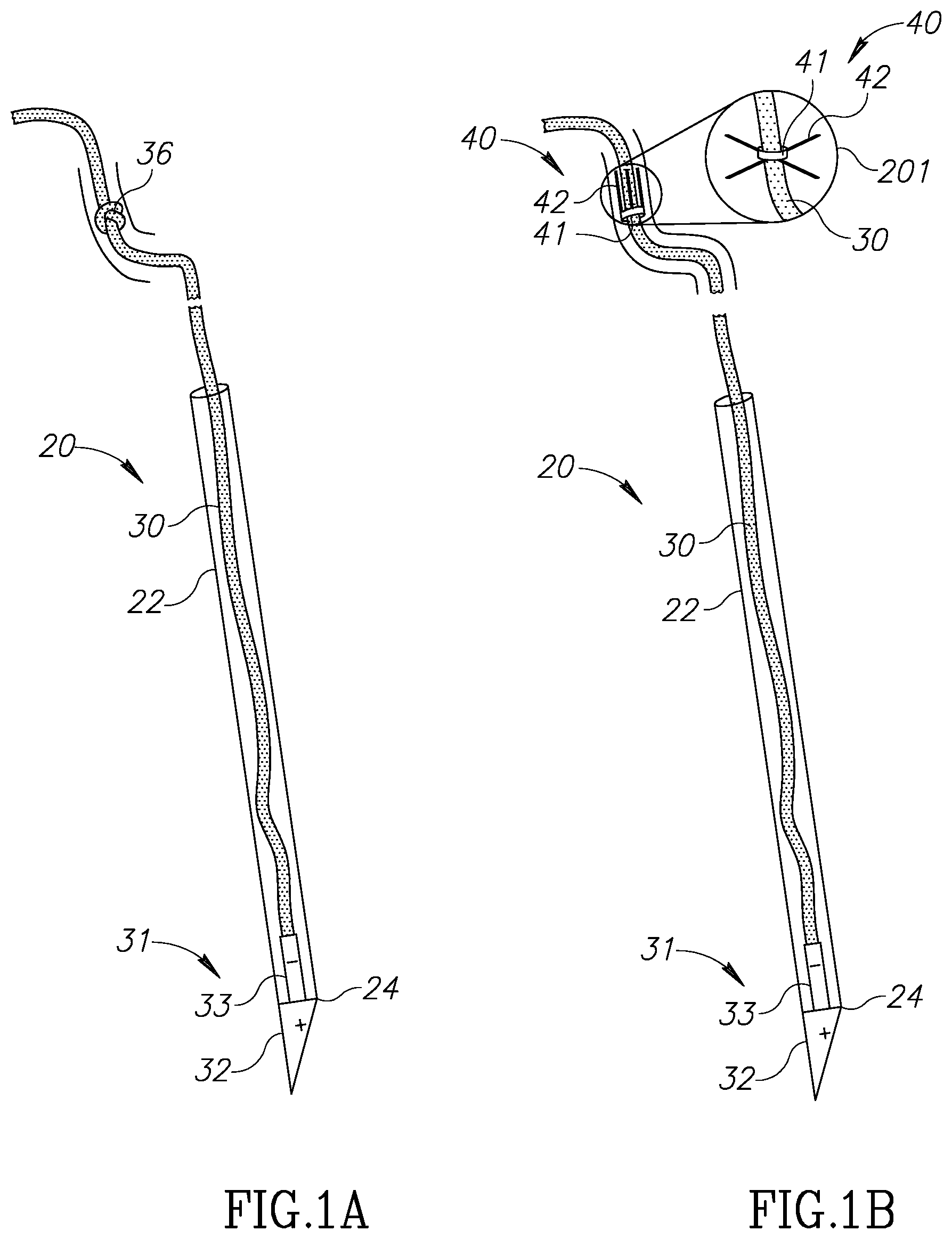 Patent US12310852 — Chorda replacement apparatus and method — Figure 1